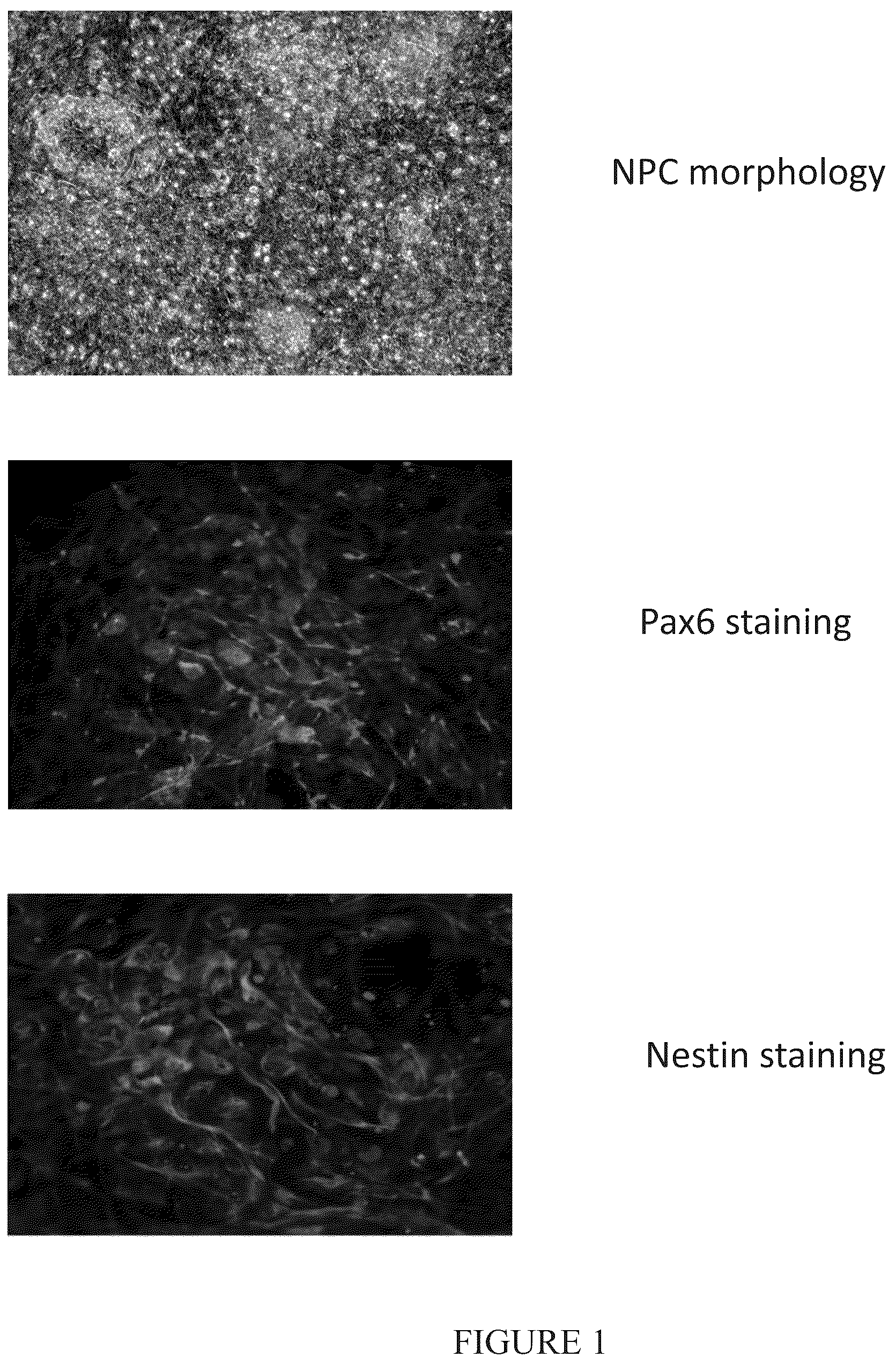 Patent US12104171 Figure 1 – Induction of neural progenitor cells, oligodendrocyte progenitor cells, and oligodendrocytes by stem cell differentiation using landmark transcription factors