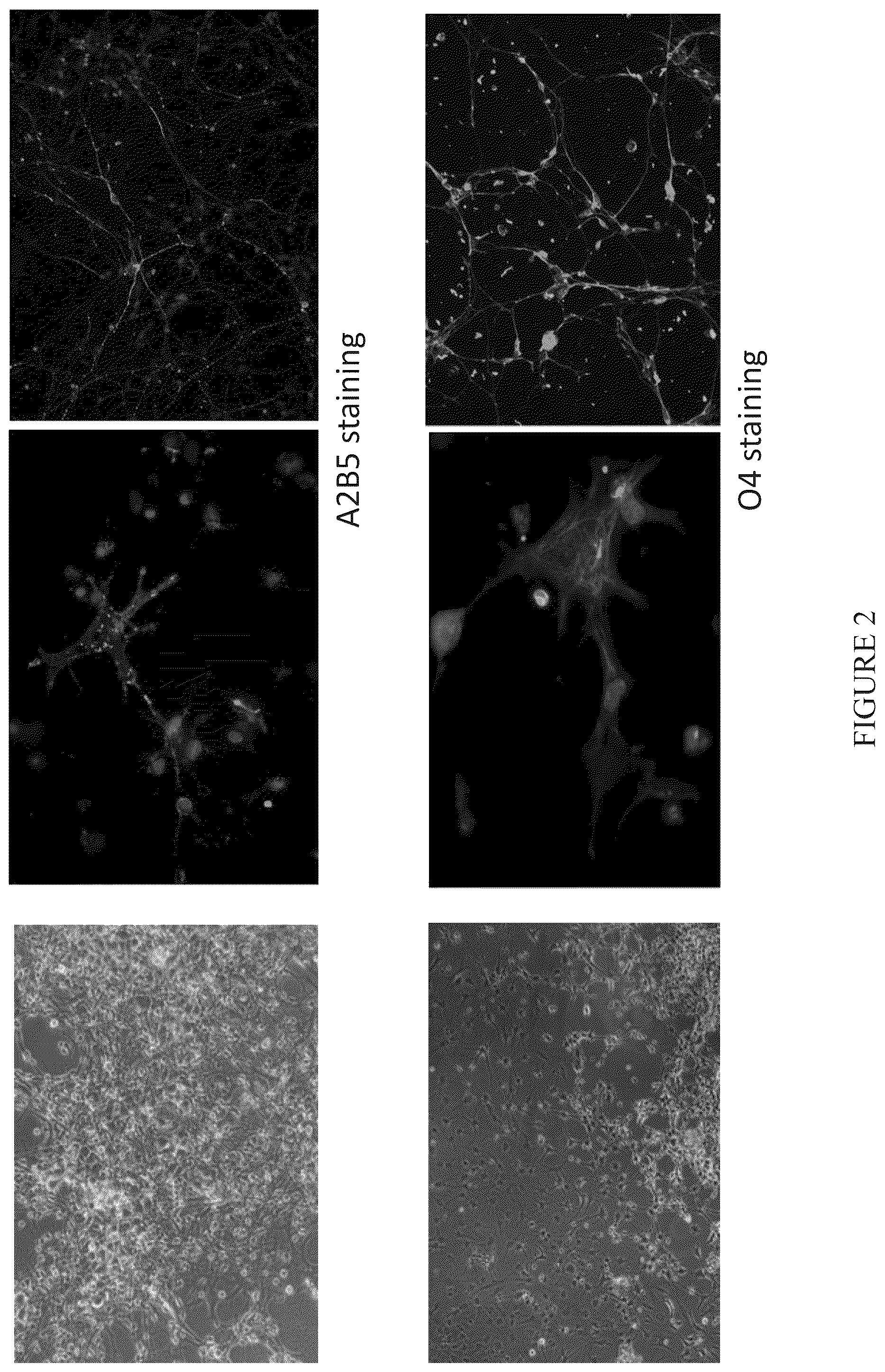 Patent US12104171 Figure 2 – Induction of neural progenitor cells, oligodendrocyte progenitor cells, and oligodendrocytes by stem cell differentiation using landmark transcription factors