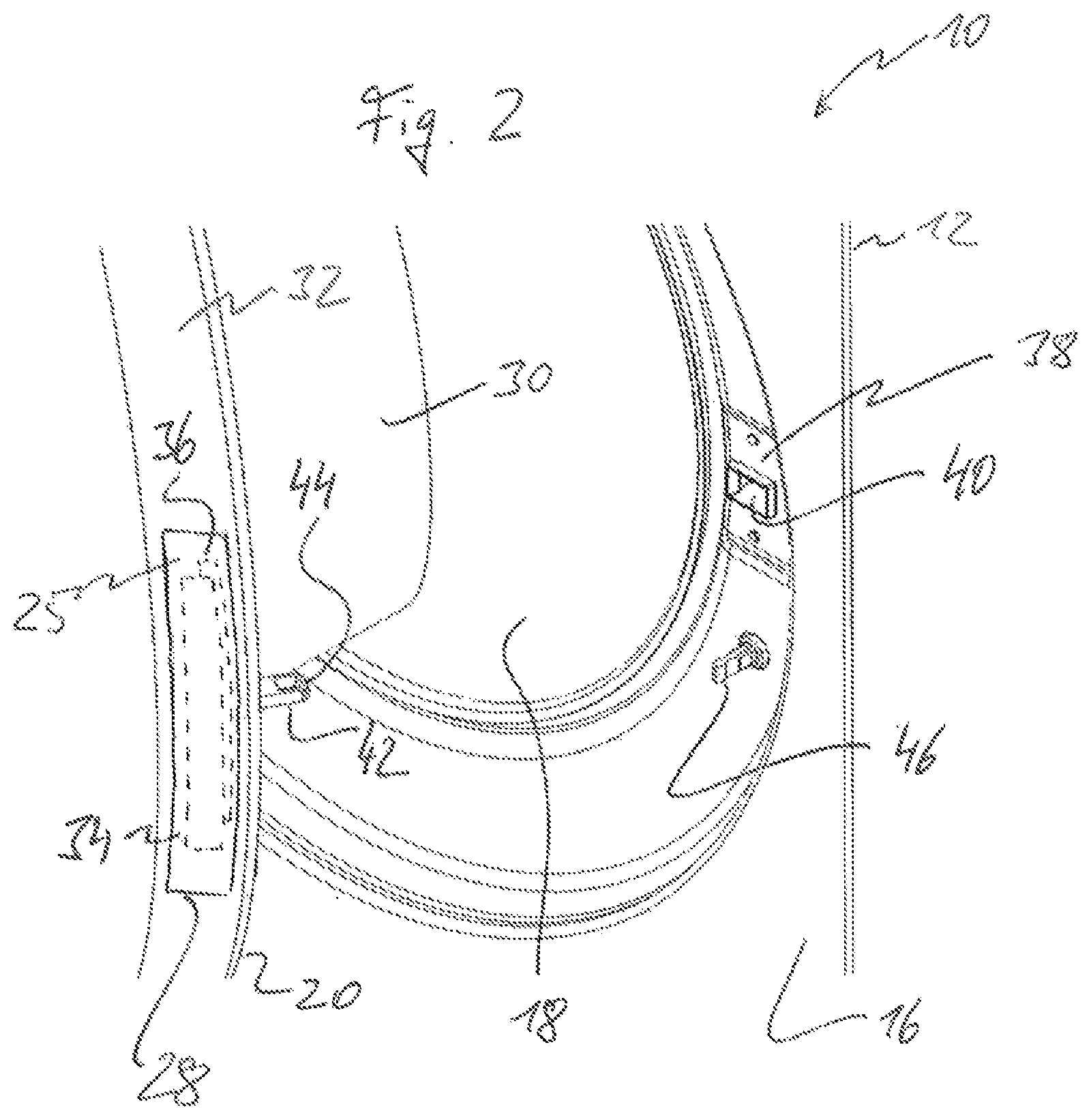 Patent US12104305 Figure 2 – Proximity control device and domestic electrical appliance equipped therewith