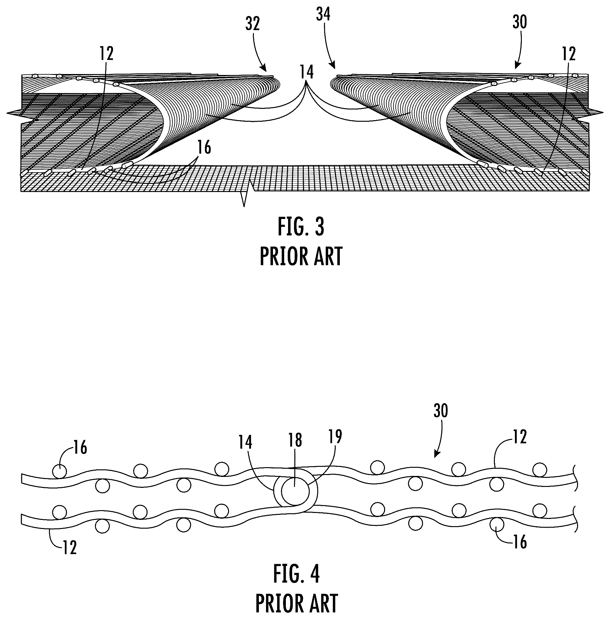 Patent US12104323 Figure 2 – Seamed press felt with partially anchored stuffer yarn packager