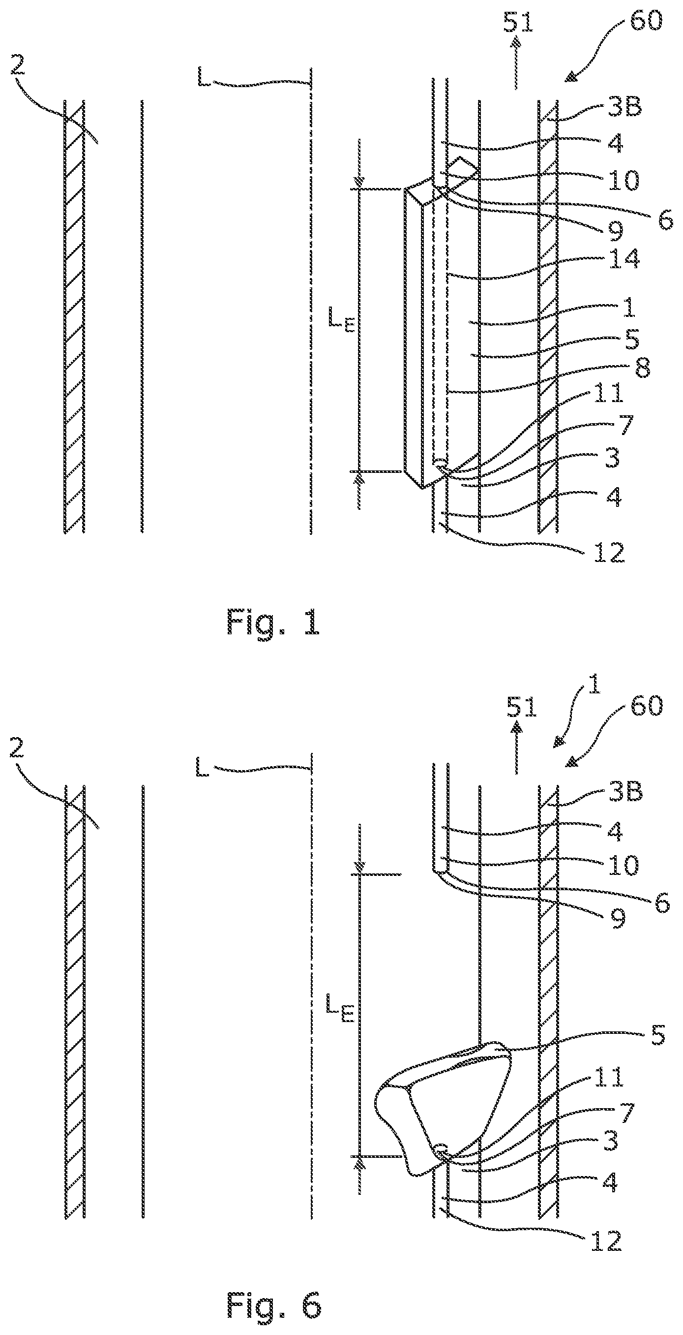 Patent US12104453 Figure 1 – Downhole assembly and annular barrier with downhole assembly