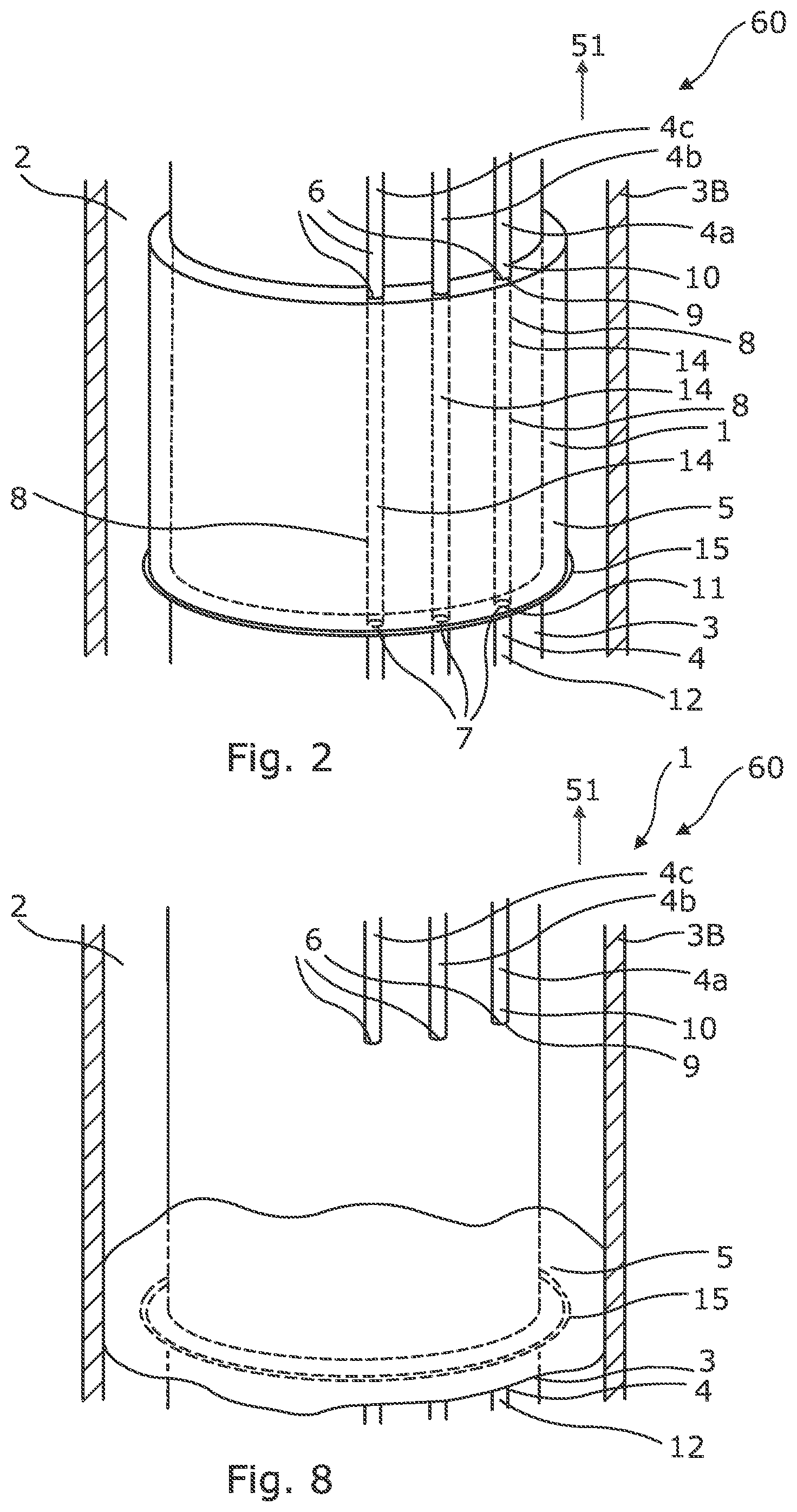 Patent US12104453 Figure 2 – Downhole assembly and annular barrier with downhole assembly