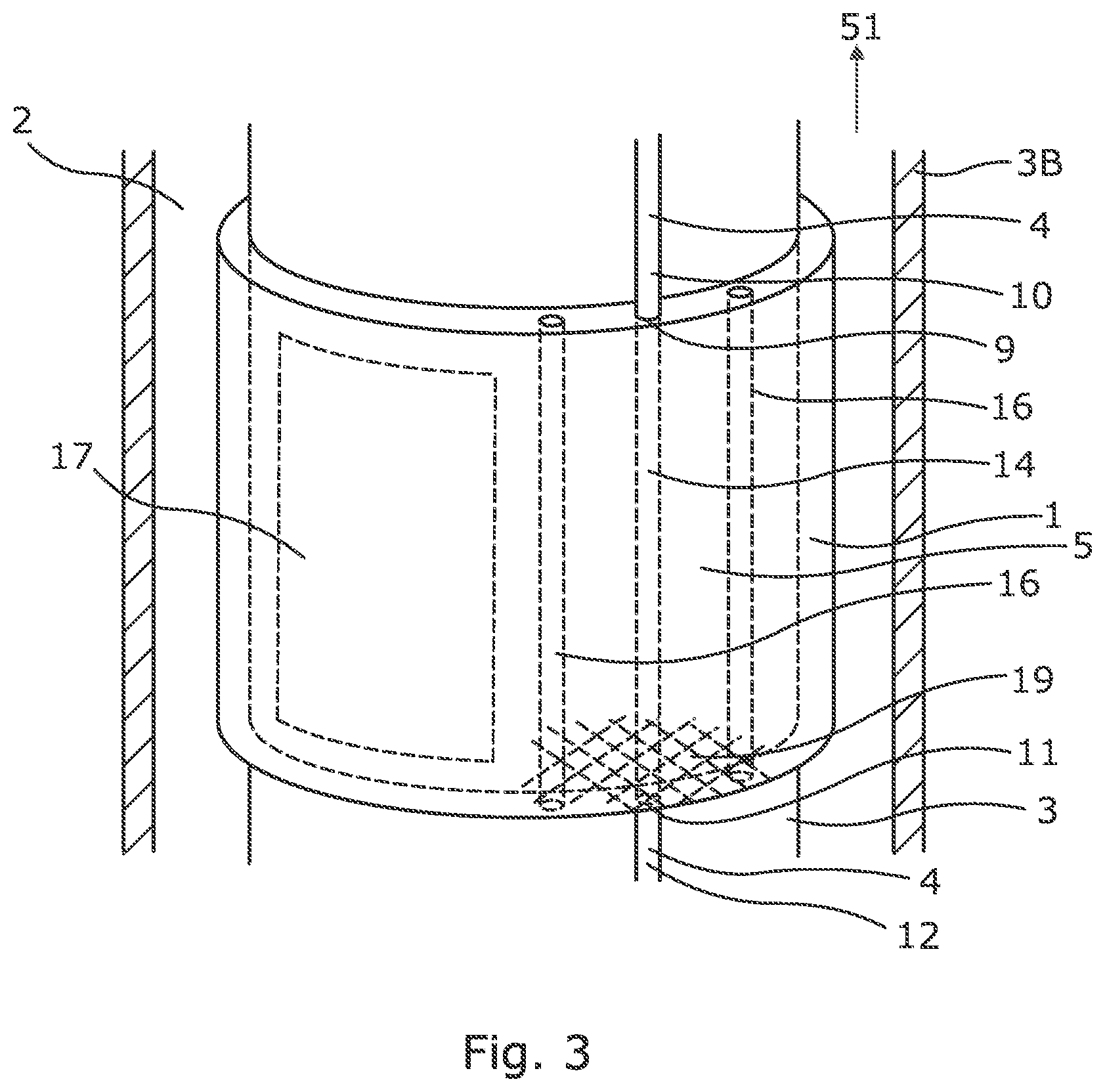 Patent US12104453 Figure 3 – Downhole assembly and annular barrier with downhole assembly