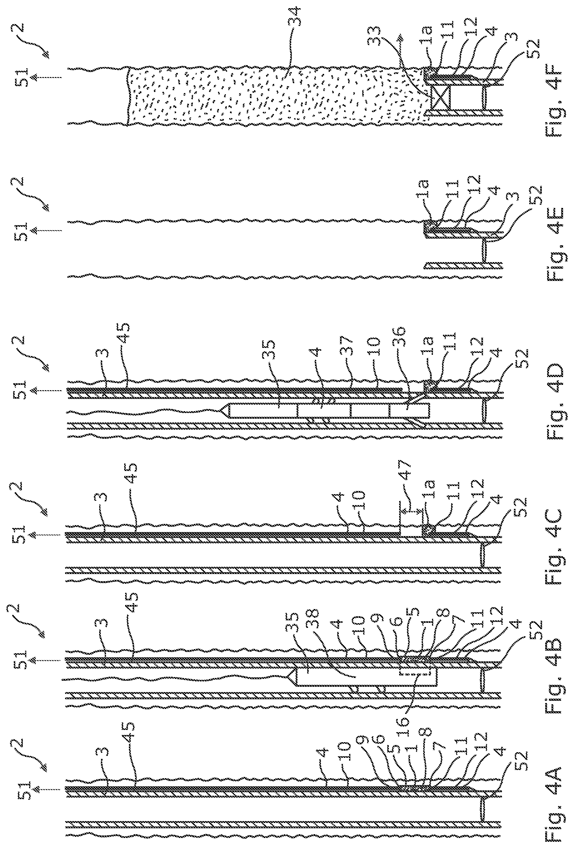 Patent US12104453 Figure 4 – Downhole assembly and annular barrier with downhole assembly