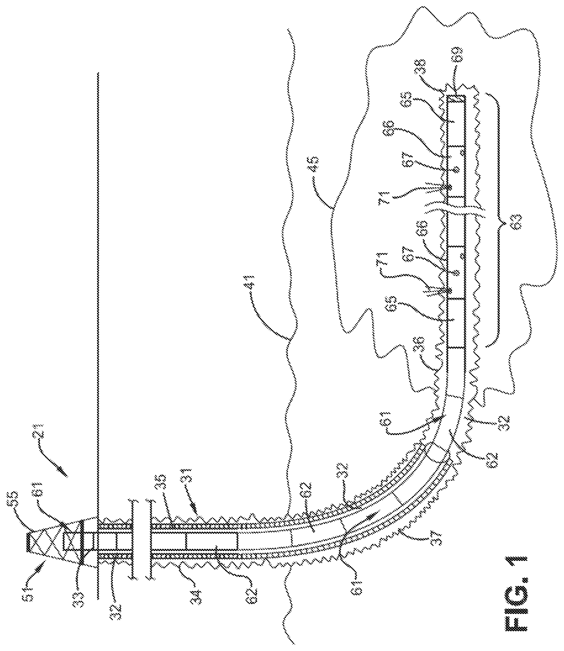 Patent US12104478 Figure 1 – Method and system for stimulating hydrocarbon production