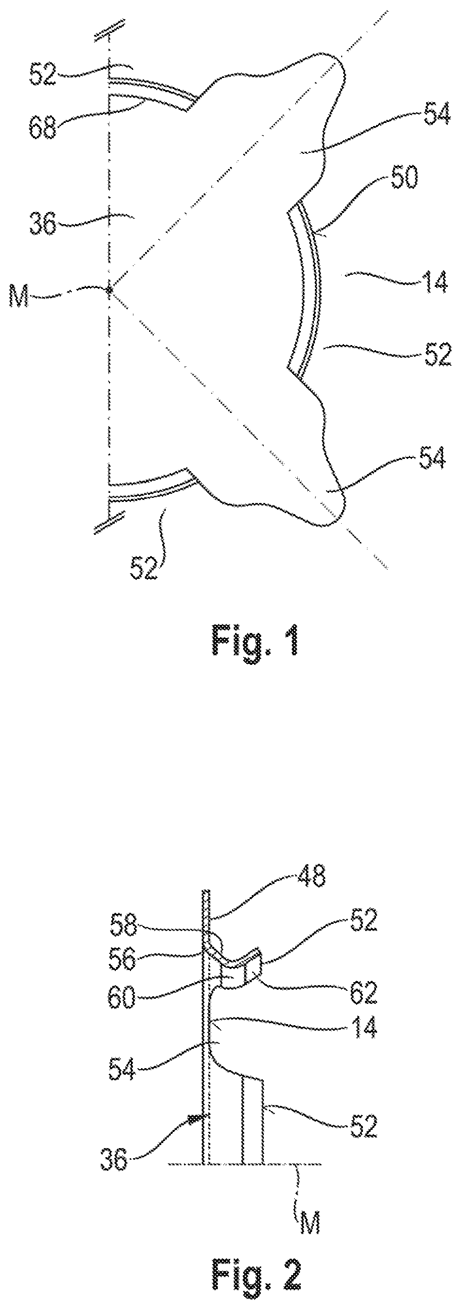 Patent US12104512 Figure 1 – Muffler and method for making the same