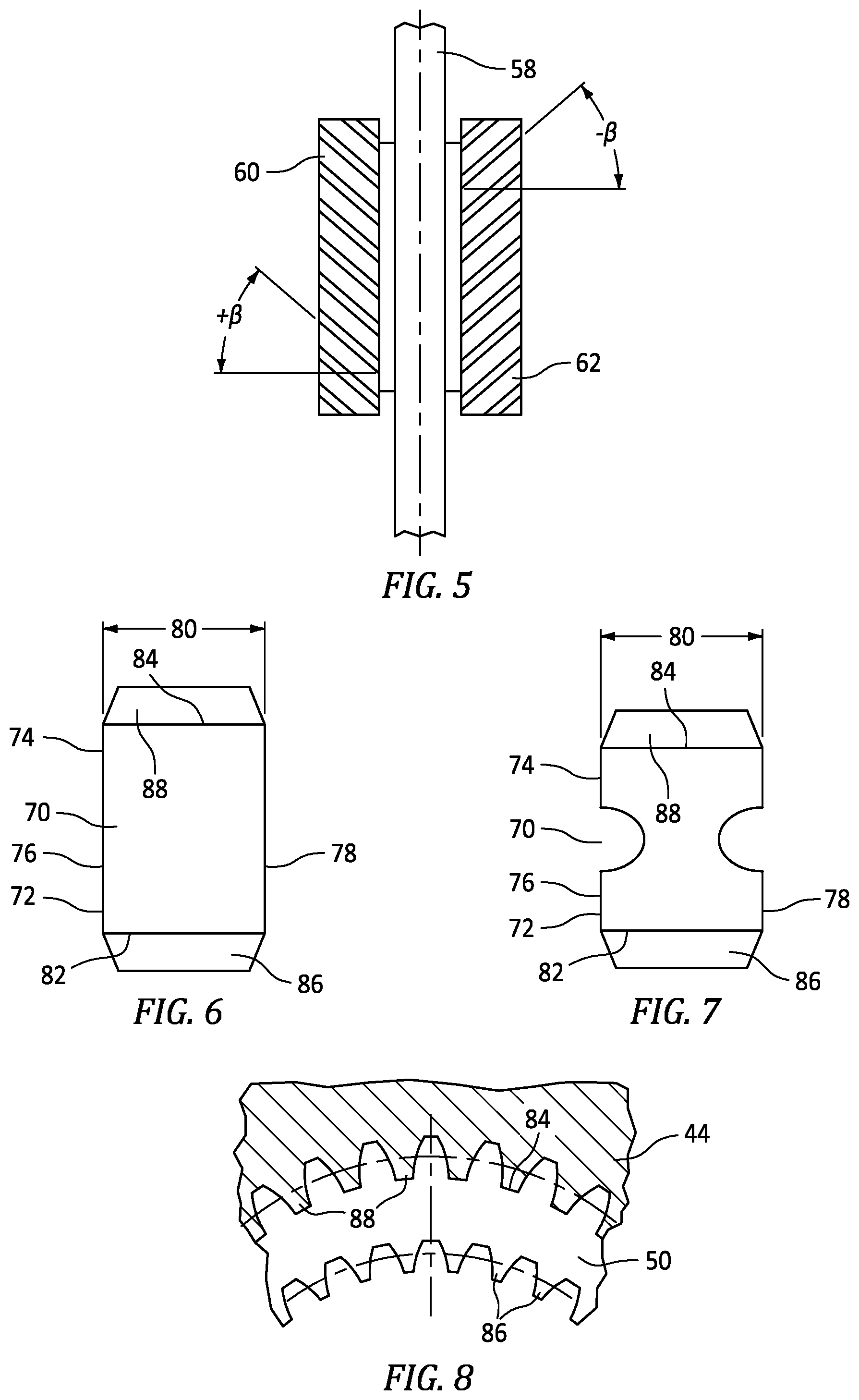 Patent US12104541 Figure 5 – Method and system for assembling a reduction gearbox
