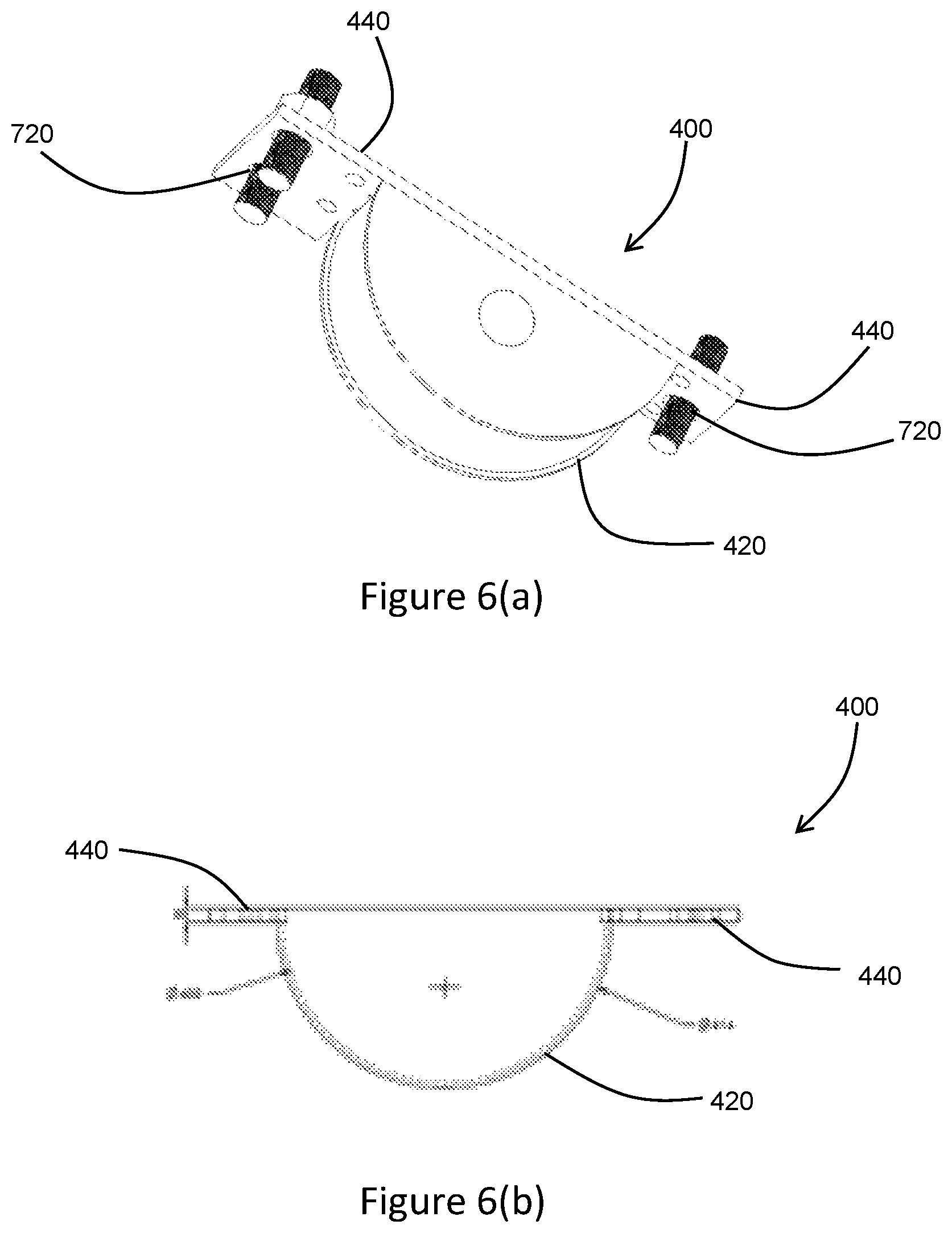 Patent US12104581 Figure 7 – Method of repairing a bearing bore and bore insert for repairing a bearing bore