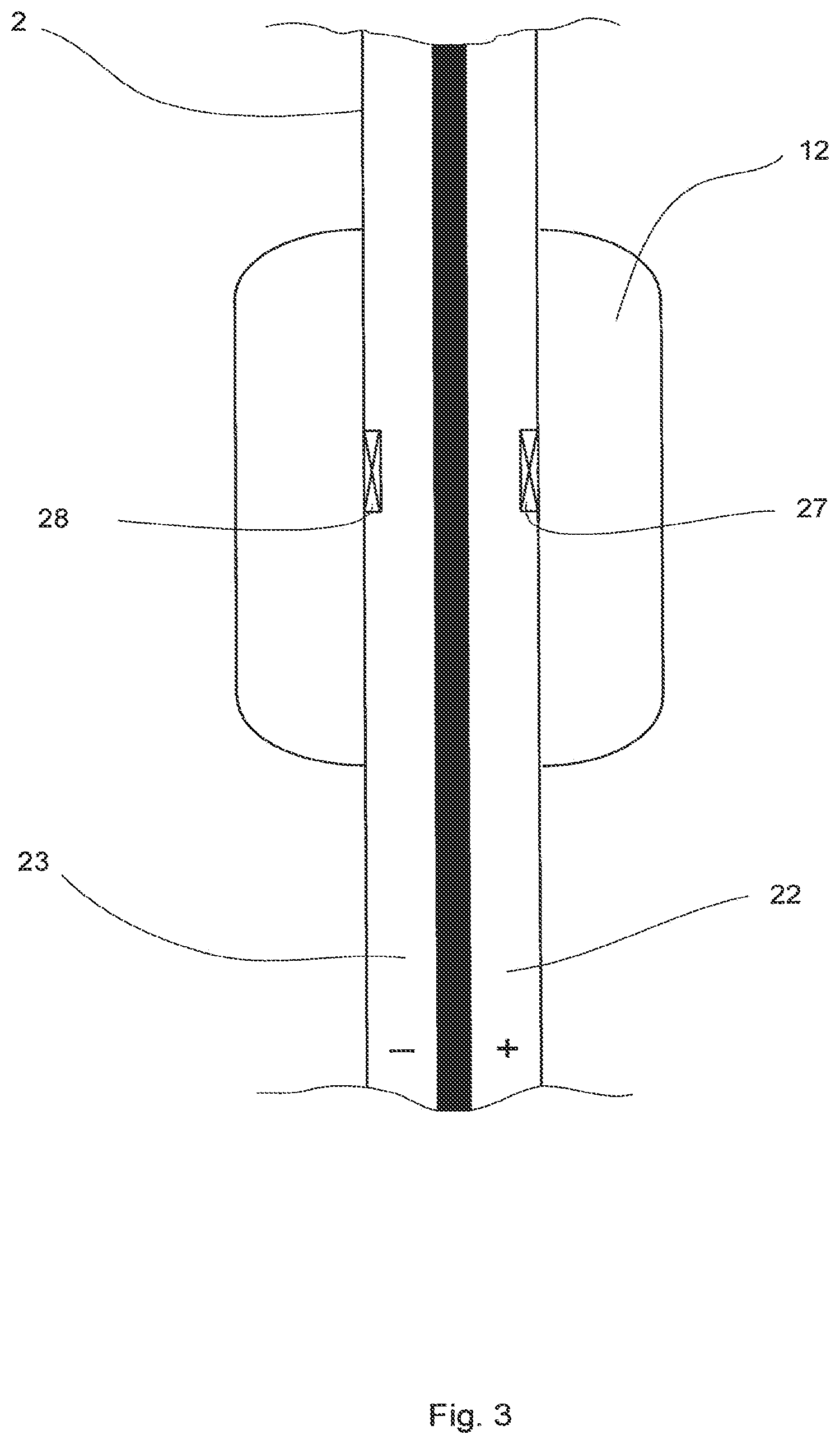 Patent US12104600 Figure 3 – Device to assist the performance of a heart