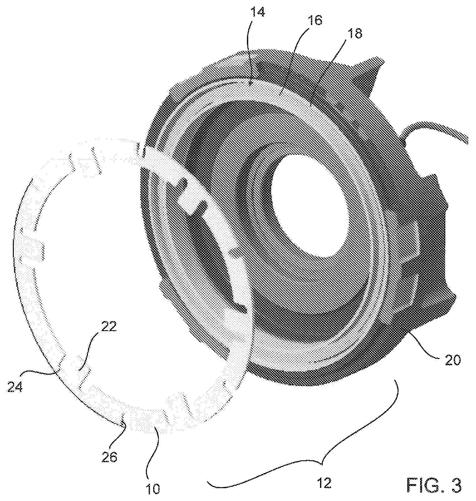 Patent US12104659 Figure 4 – Flexible armature plate for an electro-magnetic overrunning clutch