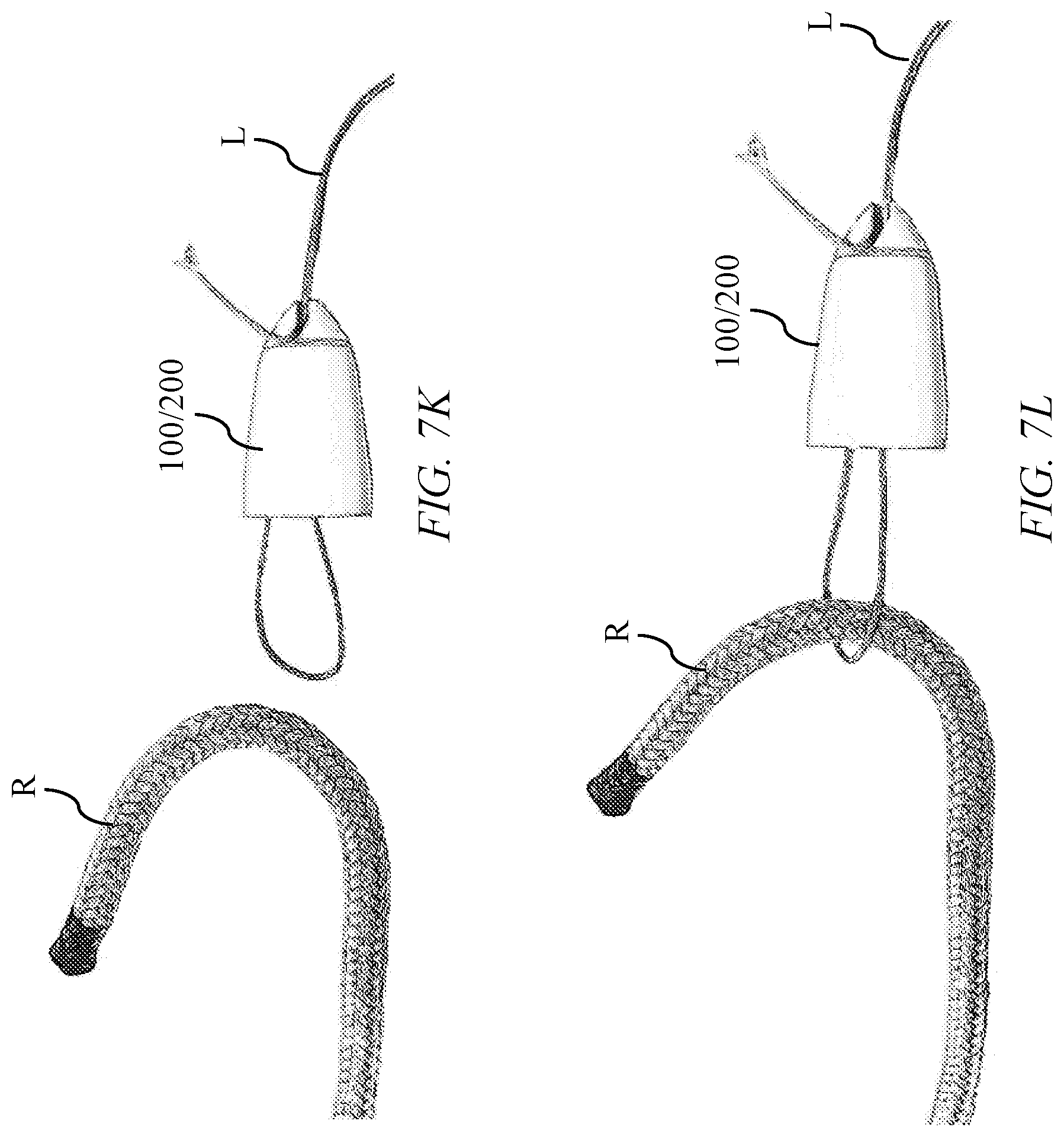 Patent US12104676 Figure 13 – Arborist device