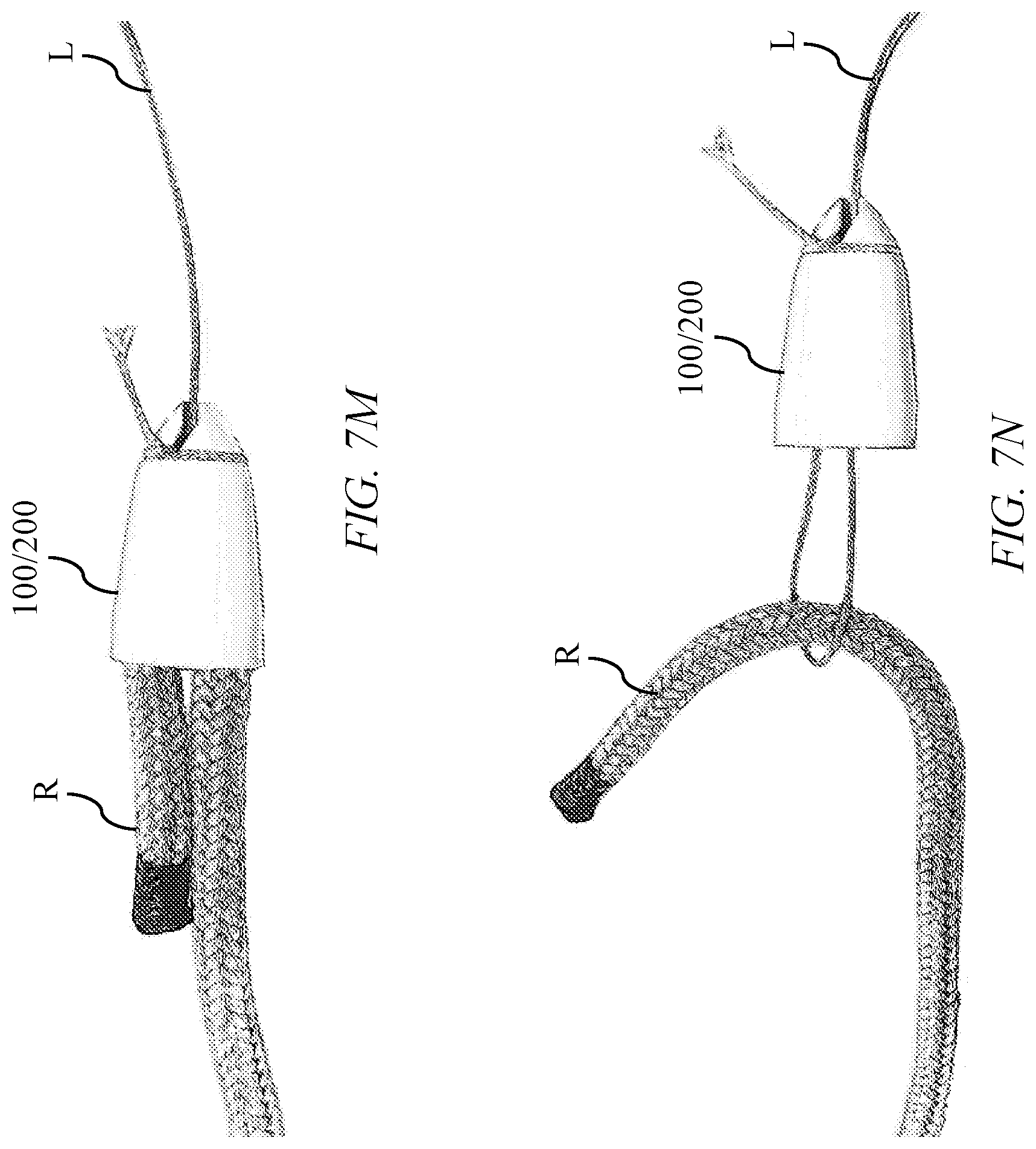 Patent US12104676 Figure 14 – Arborist device