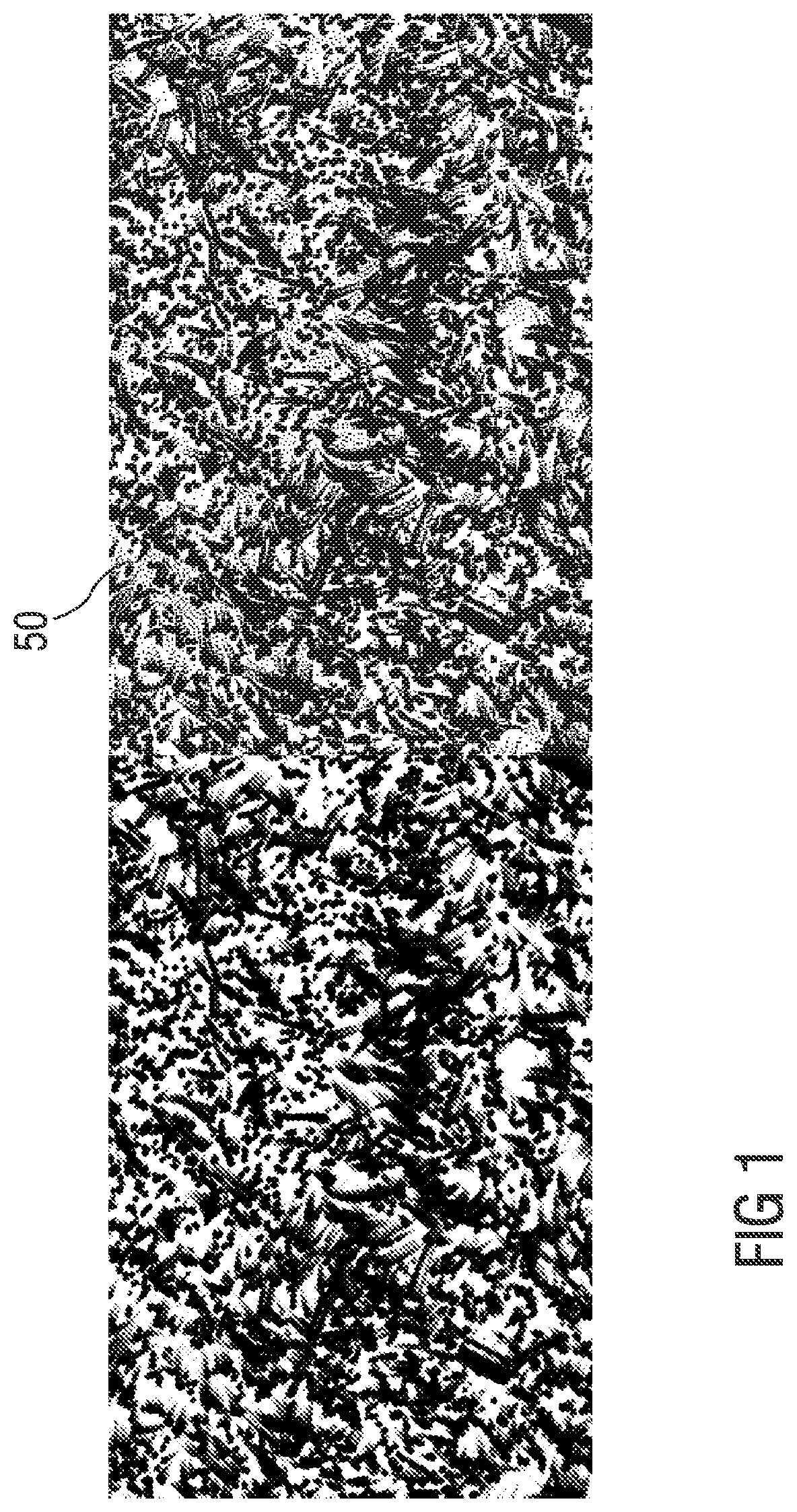 Patent US12104969 — Sensor for detecting pressure and/or filling level and/or flow rate and/or density and/or mass and/or temperature — Figure 1
