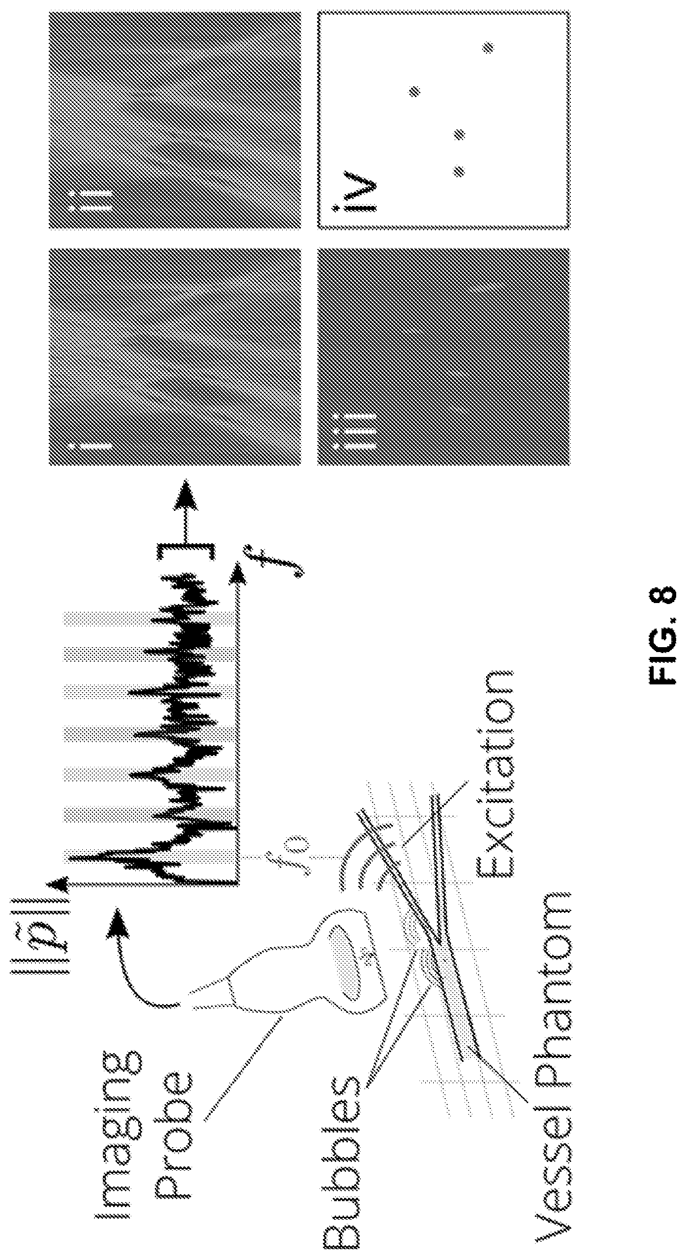 Patent US12105052 Figure 10 – Systems and methods for ultrasound imaging and focusing