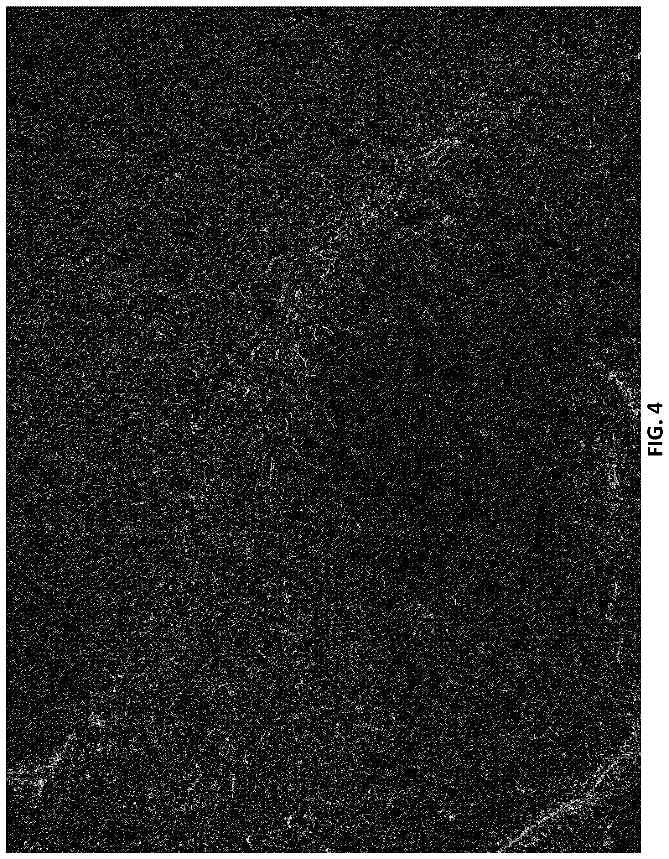 Patent US12105088 Figure 4 – Methods and materials for identifying and treating autoimmune GFAP astrocytopathy
