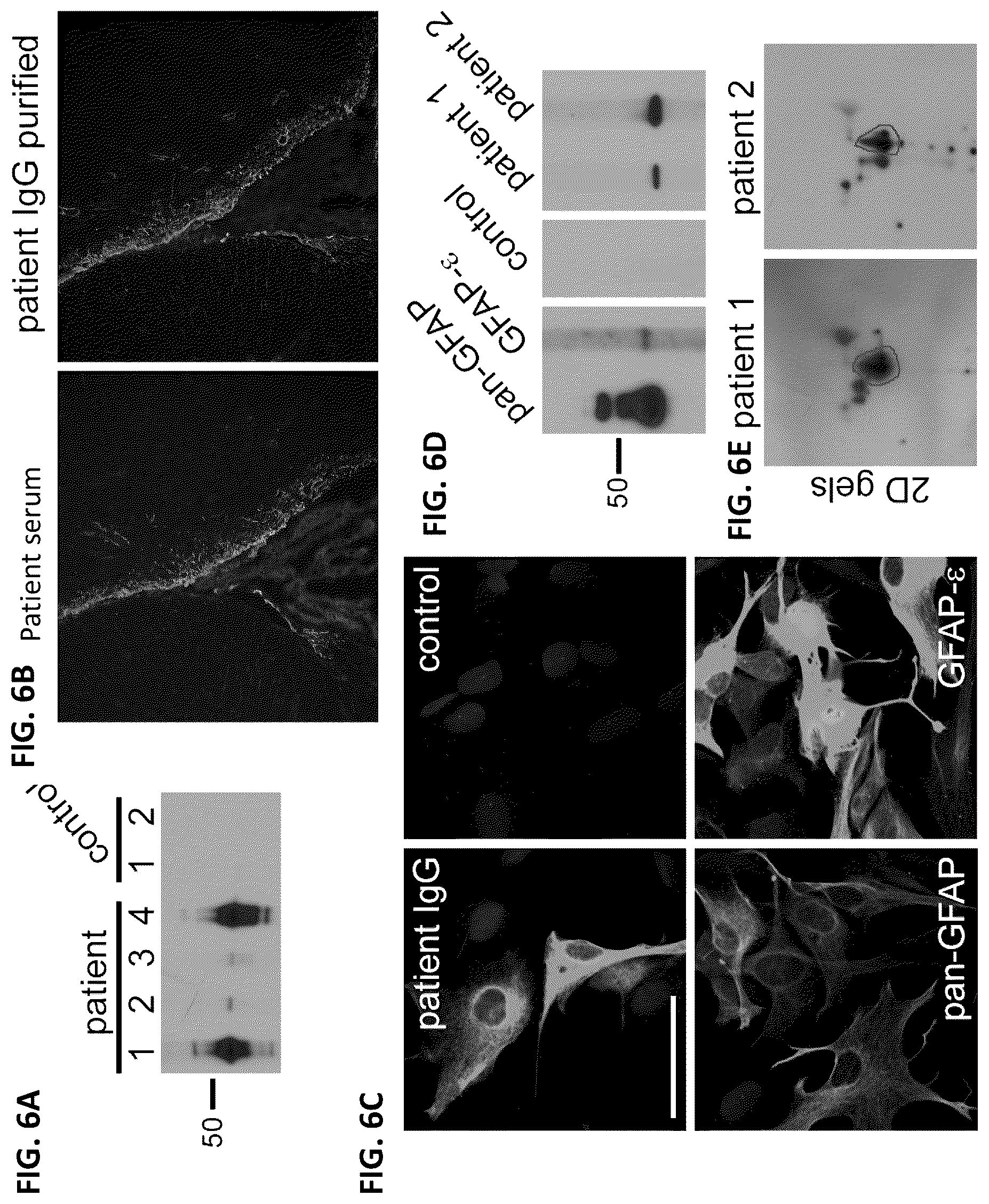 Patent US12105088 Figure 6 – Methods and materials for identifying and treating autoimmune GFAP astrocytopathy