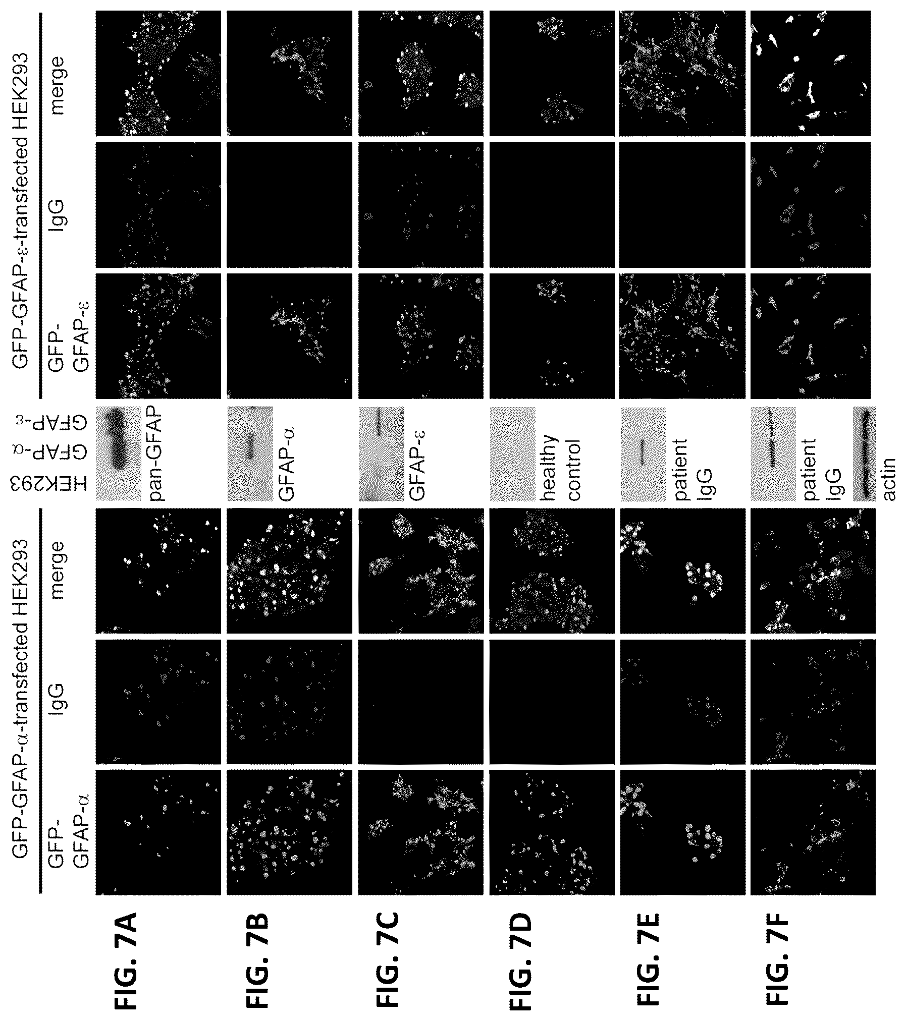 Patent US12105088 Figure 7 – Methods and materials for identifying and treating autoimmune GFAP astrocytopathy
