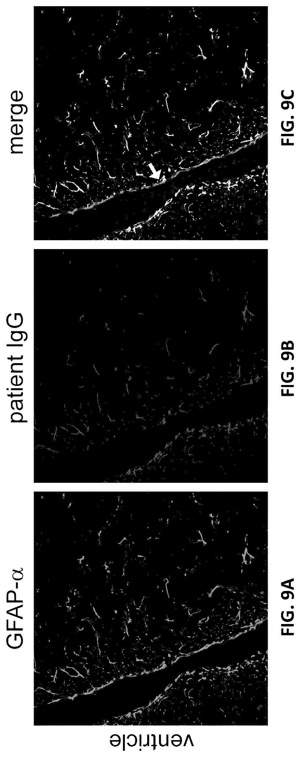 Patent US12105088 Figure 9 – Methods and materials for identifying and treating autoimmune GFAP astrocytopathy