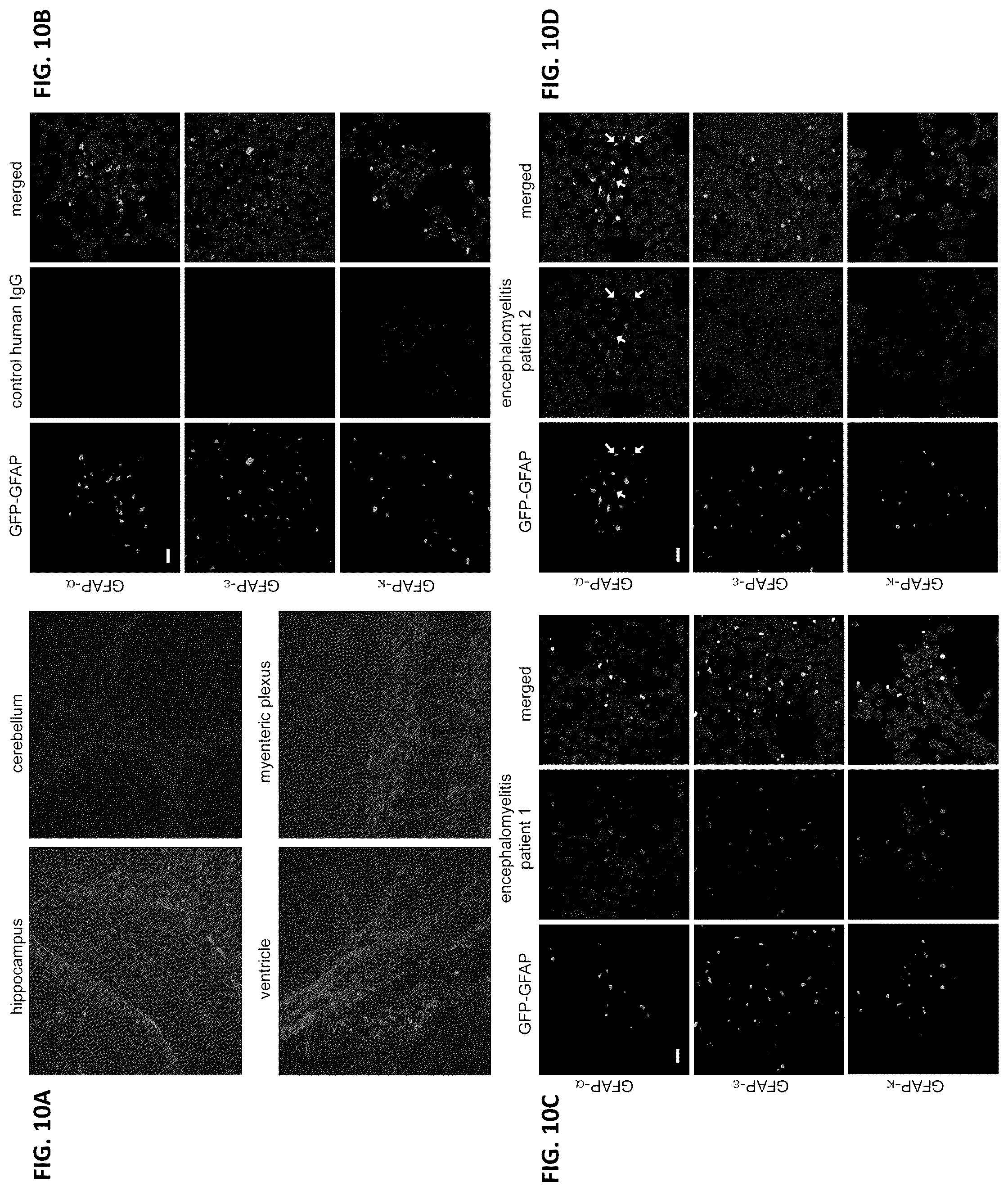 Patent US12105088 Figure 10 – Methods and materials for identifying and treating autoimmune GFAP astrocytopathy