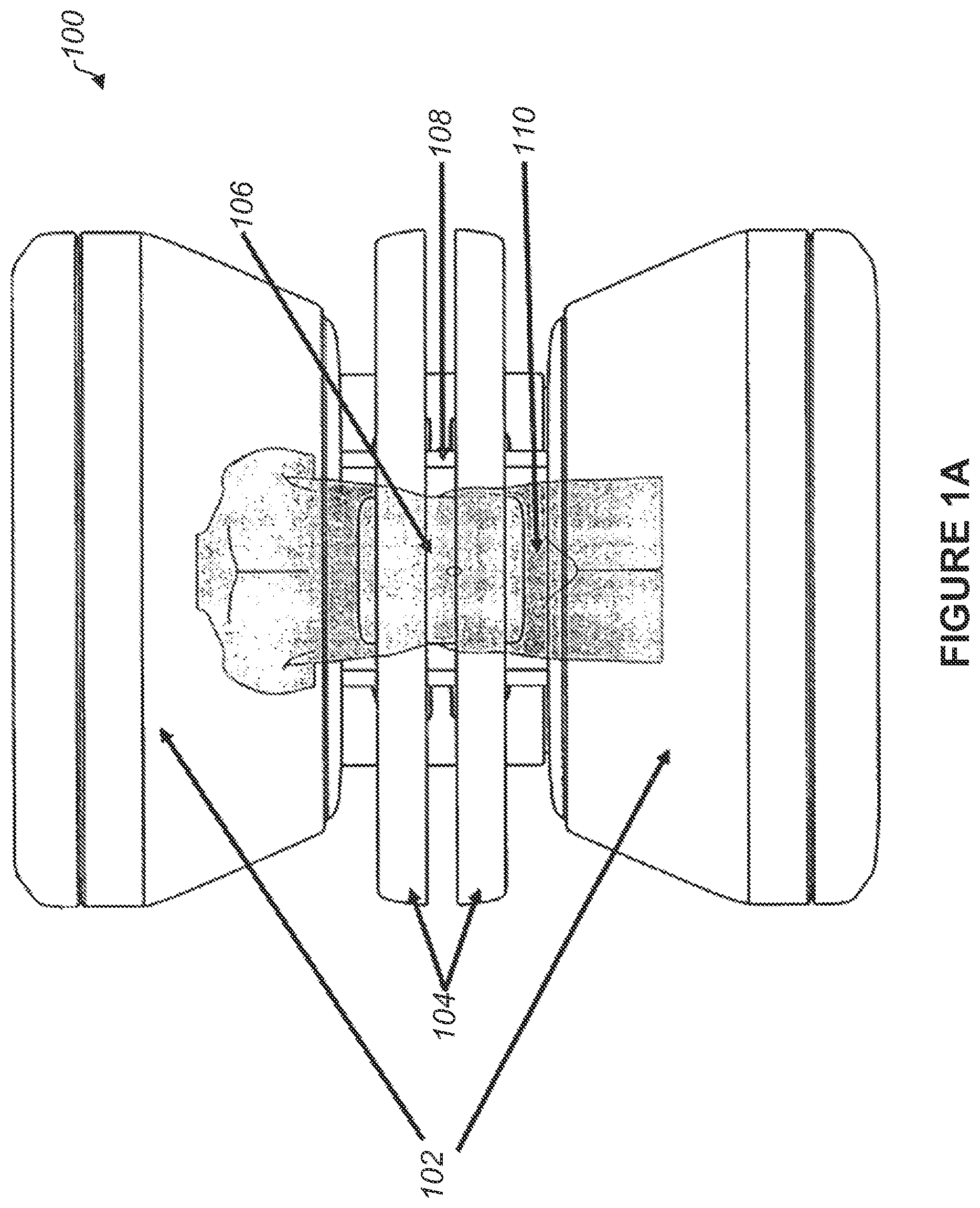Patent US12105166 Figure 1 – Method and apparatus for shielding a linear accelerator and a magnetic resonance imaging device from each other