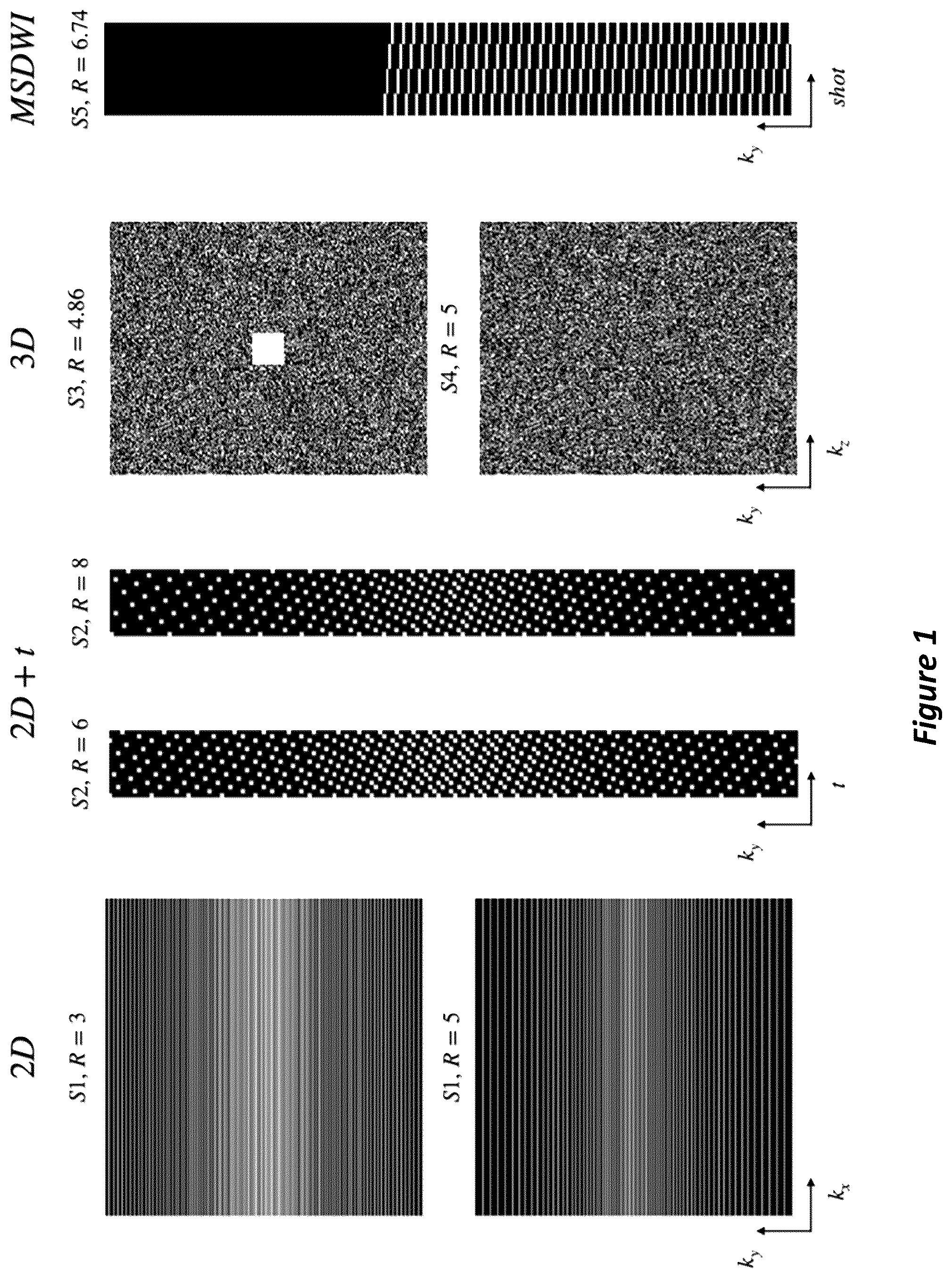 Patent US12105169 Figure 1 – High-dimensional fast convolutional framework (HICU) for calibrationless MRI