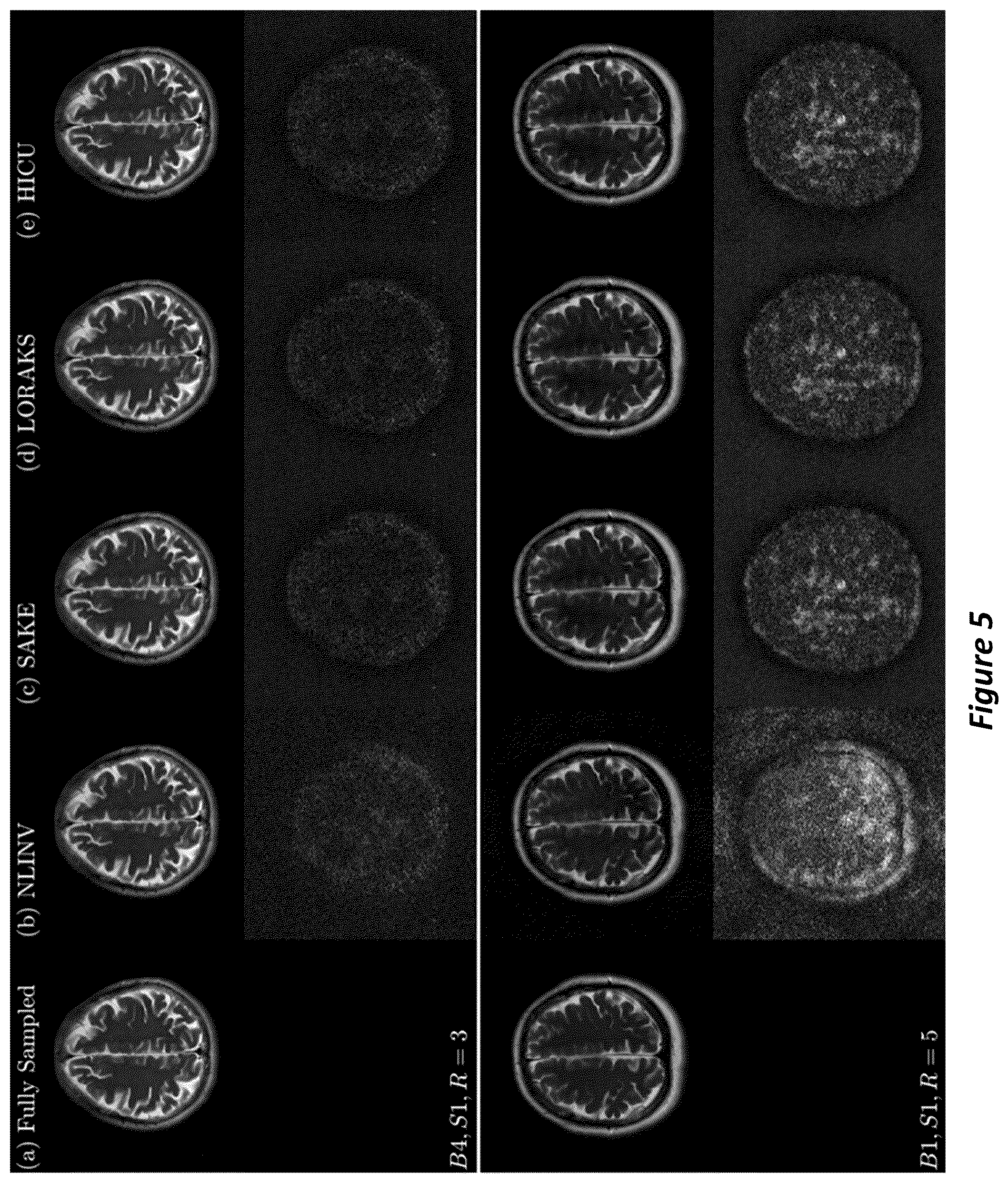 Patent US12105169 Figure 5 – High-dimensional fast convolutional framework (HICU) for calibrationless MRI