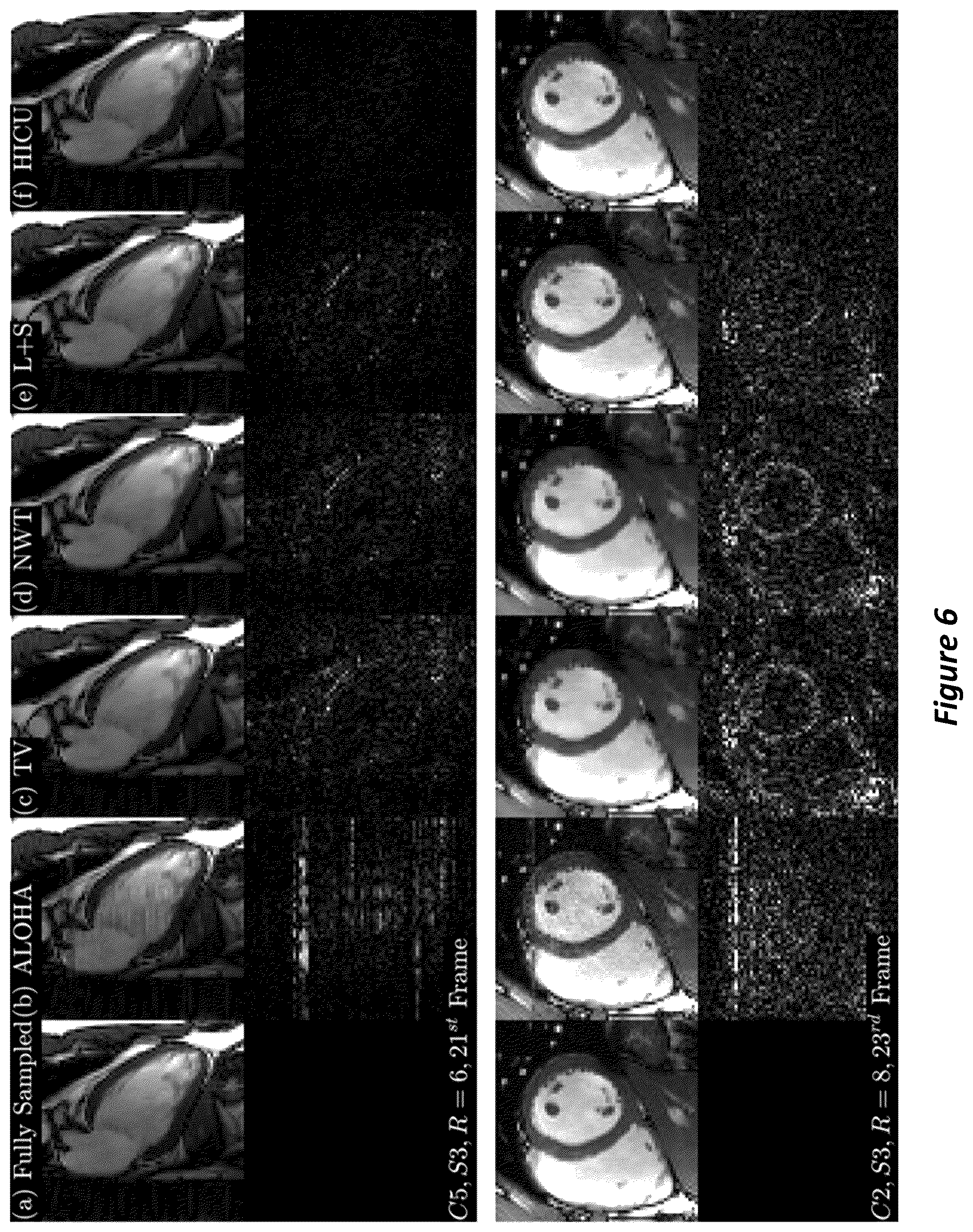 Patent US12105169 Figure 6 – High-dimensional fast convolutional framework (HICU) for calibrationless MRI