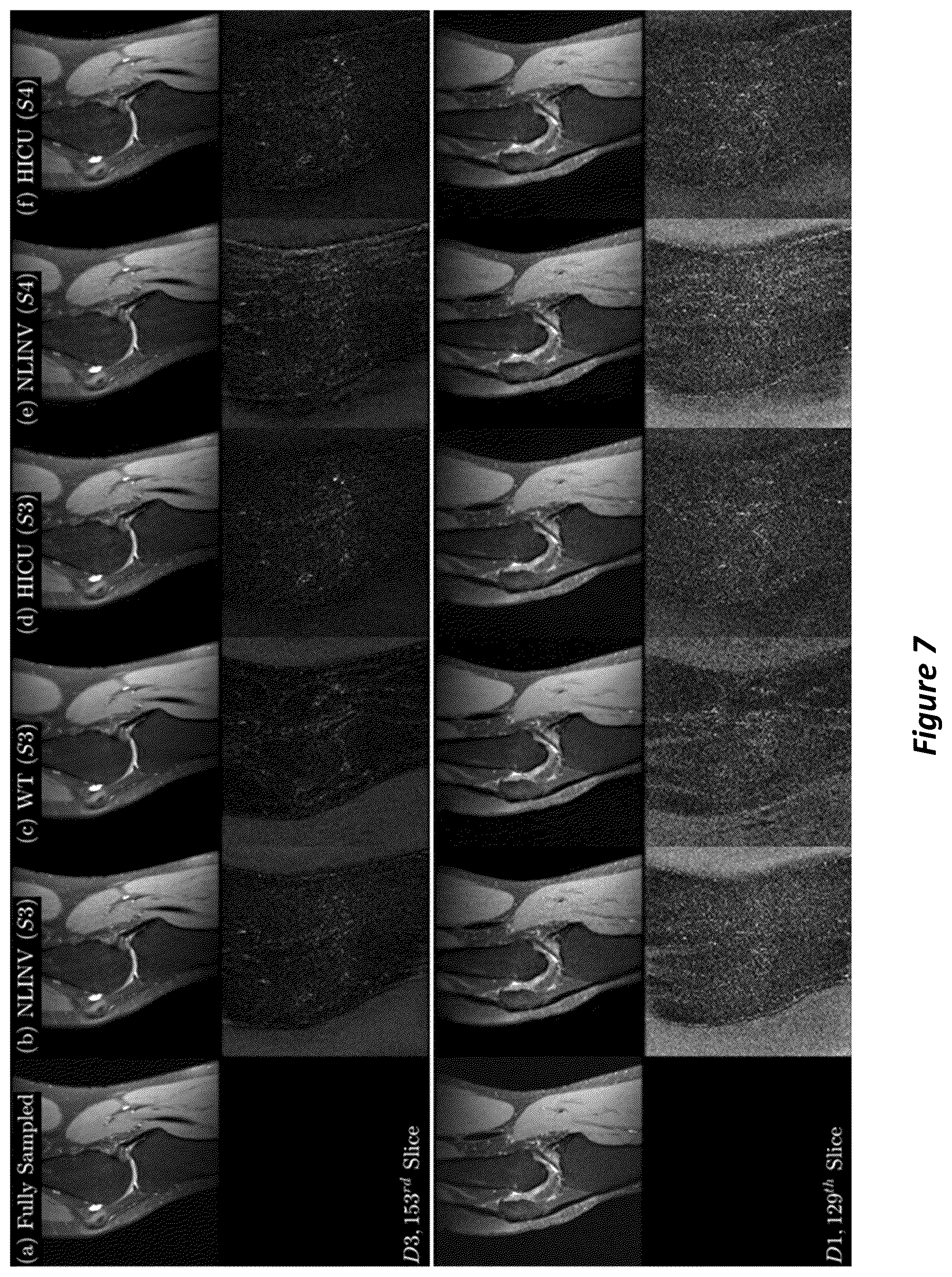 Patent US12105169 Figure 7 – High-dimensional fast convolutional framework (HICU) for calibrationless MRI