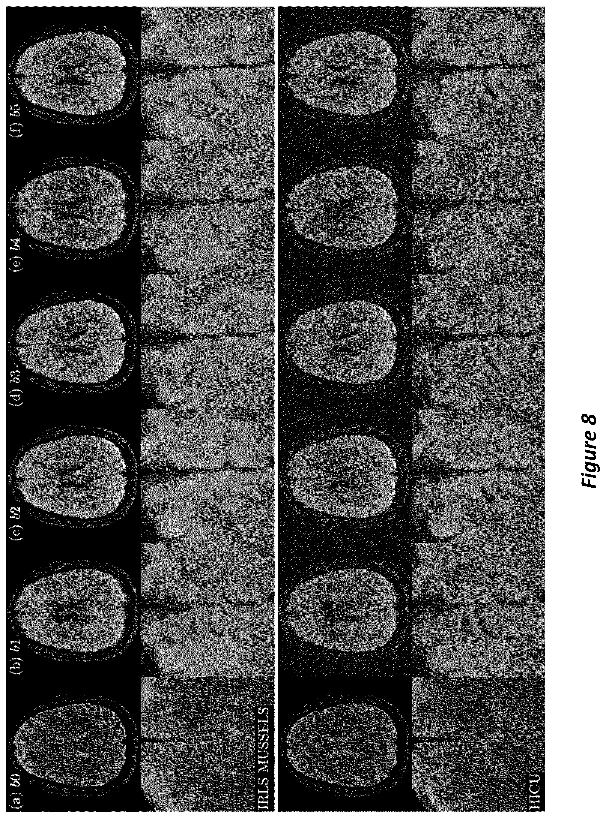 Patent US12105169 Figure 8 – High-dimensional fast convolutional framework (HICU) for calibrationless MRI