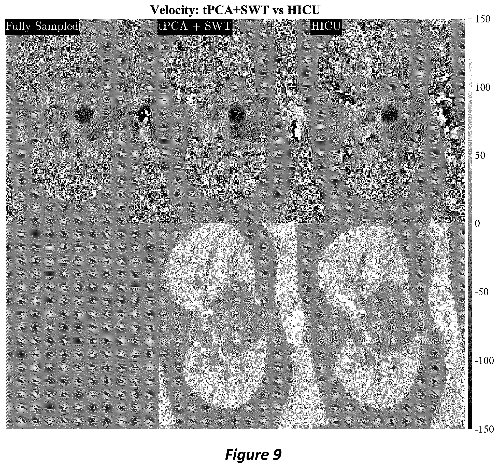 Patent US12105169 Figure 9 – High-dimensional fast convolutional framework (HICU) for calibrationless MRI