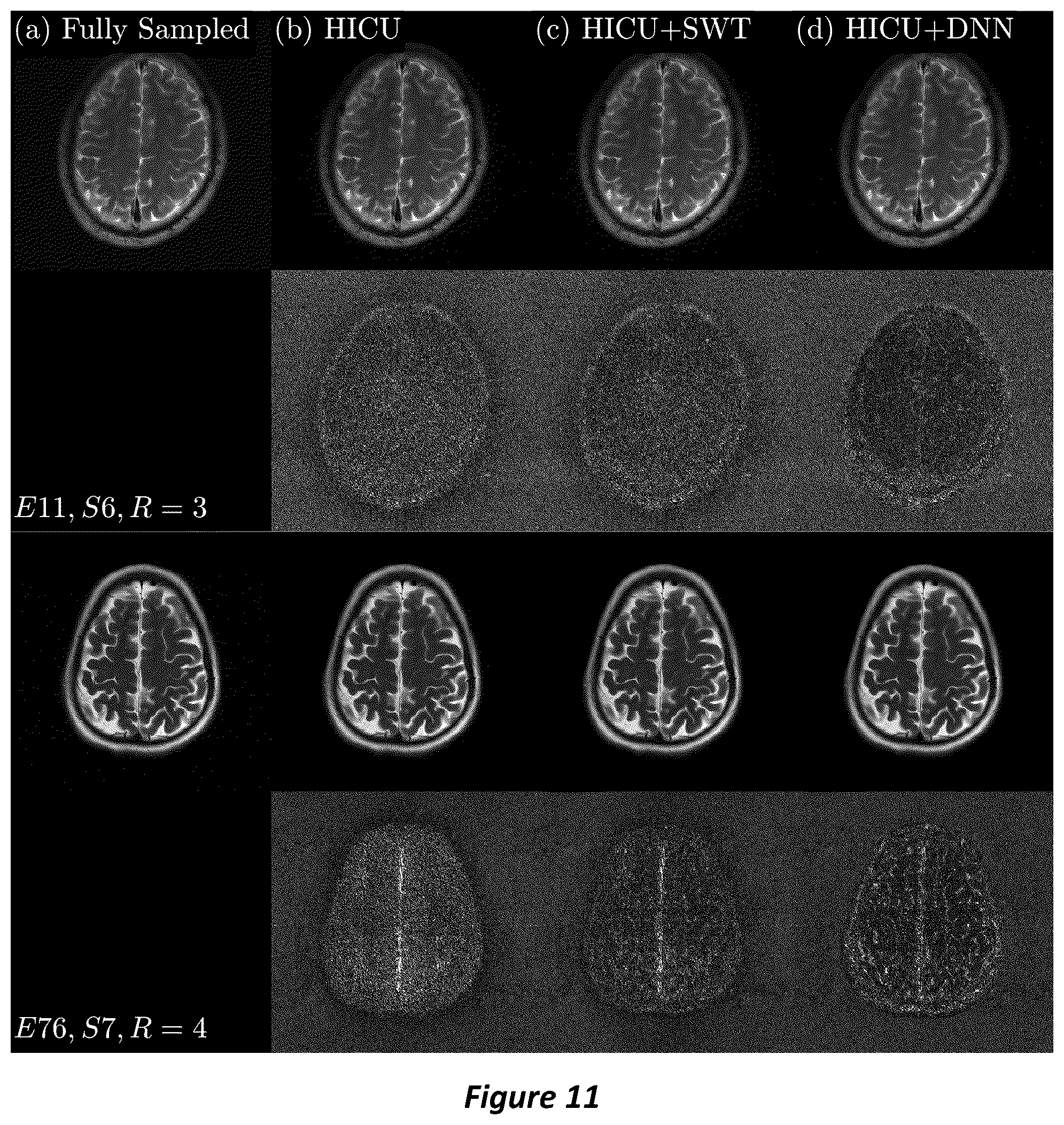 Patent US12105169 Figure 11 – High-dimensional fast convolutional framework (HICU) for calibrationless MRI