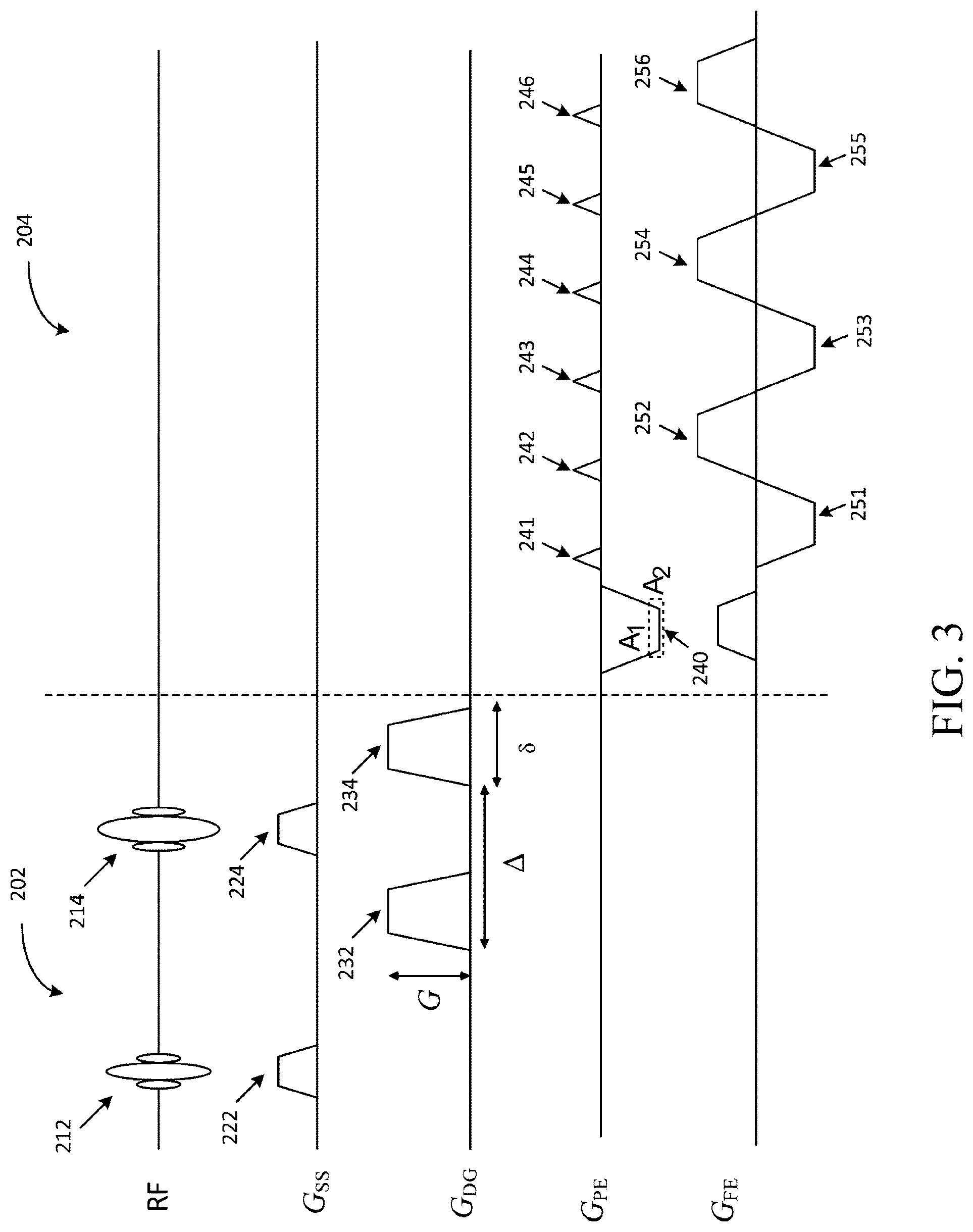 Patent US12105170 Figure 3 – Magnetic resonance imaging system and method, and computer-readable storage medium