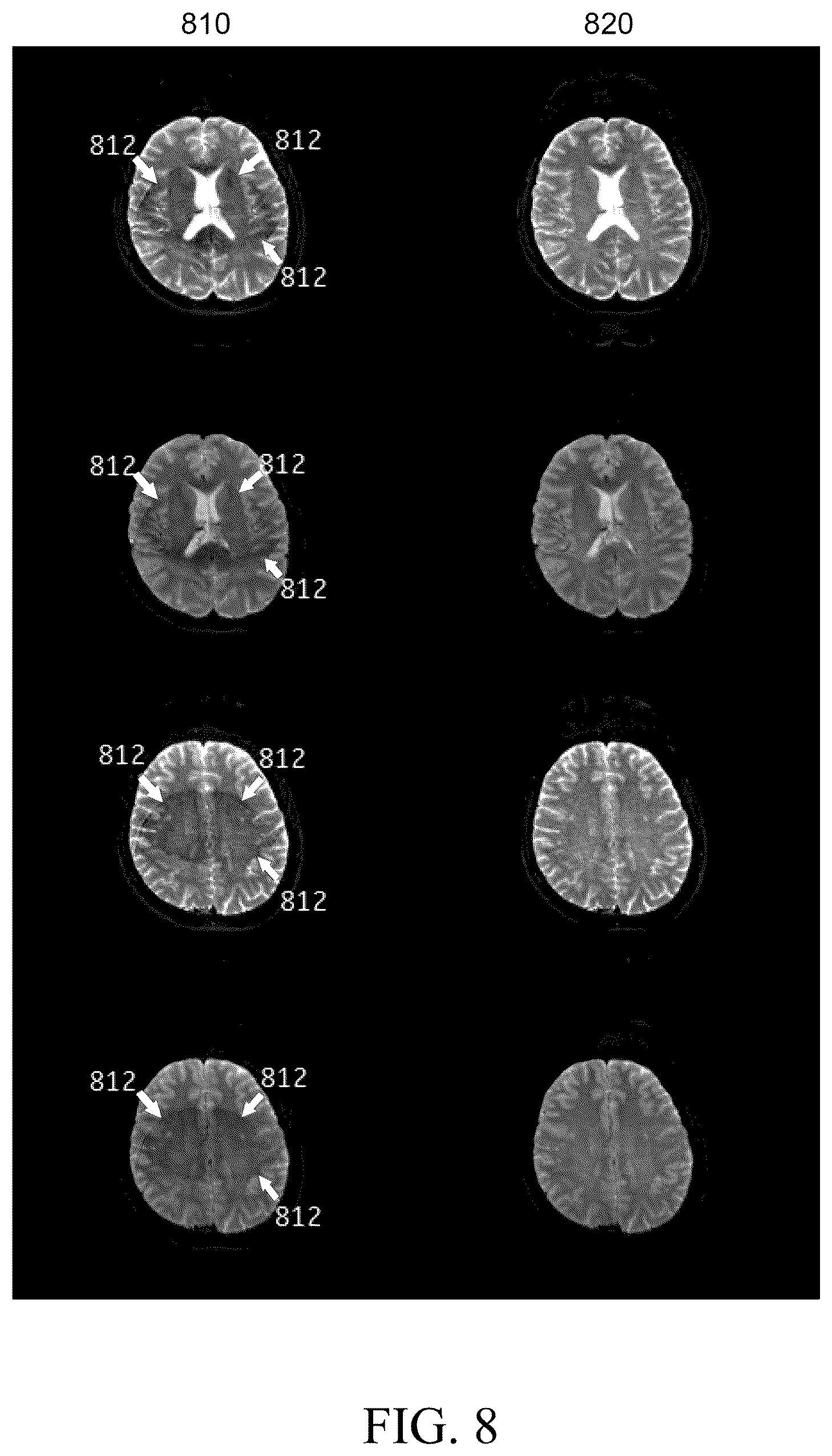 Patent US12105170 Figure 8 – Magnetic resonance imaging system and method, and computer-readable storage medium