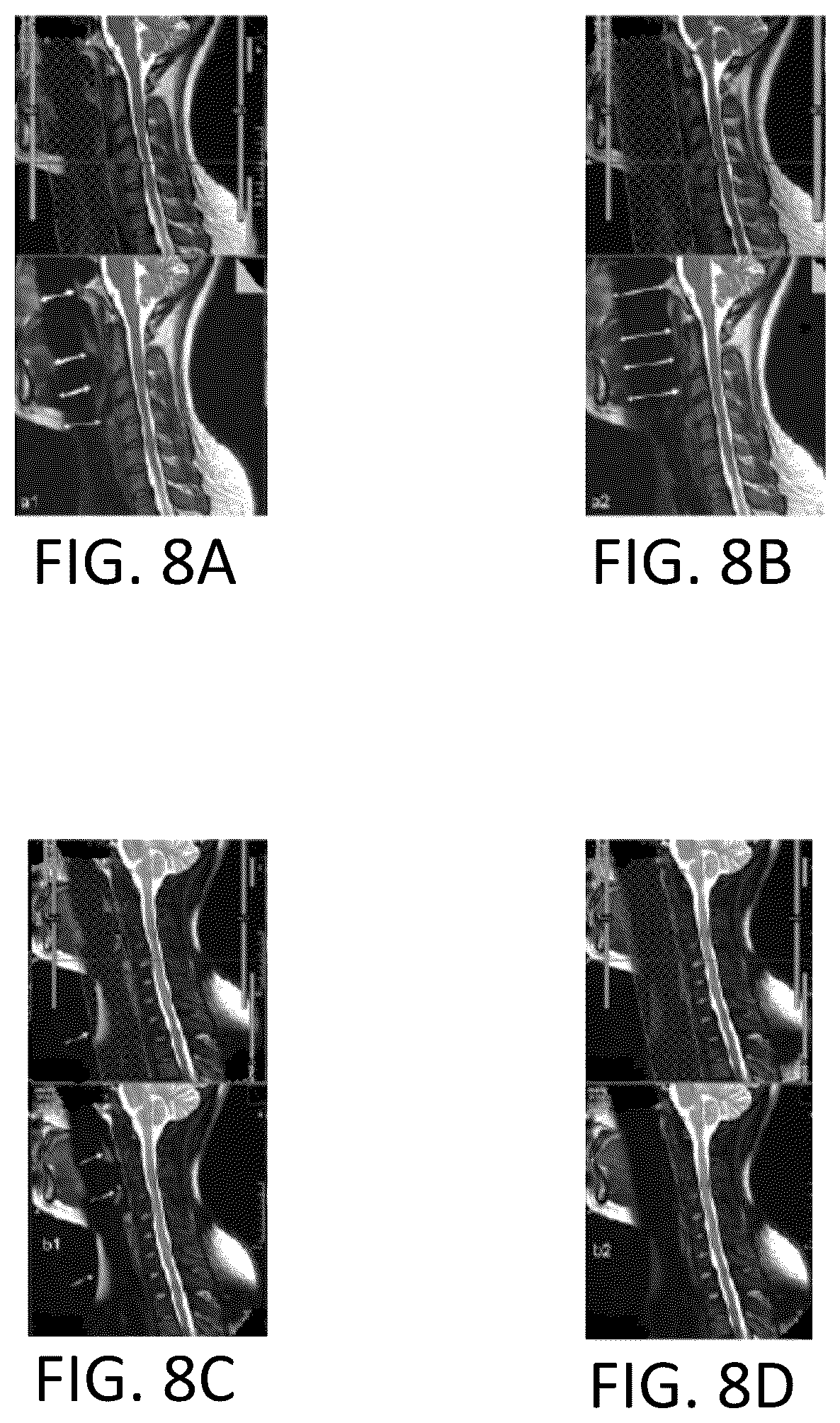Patent US12105171 Figure 8 – System for automatically controlling chemical shift direction
