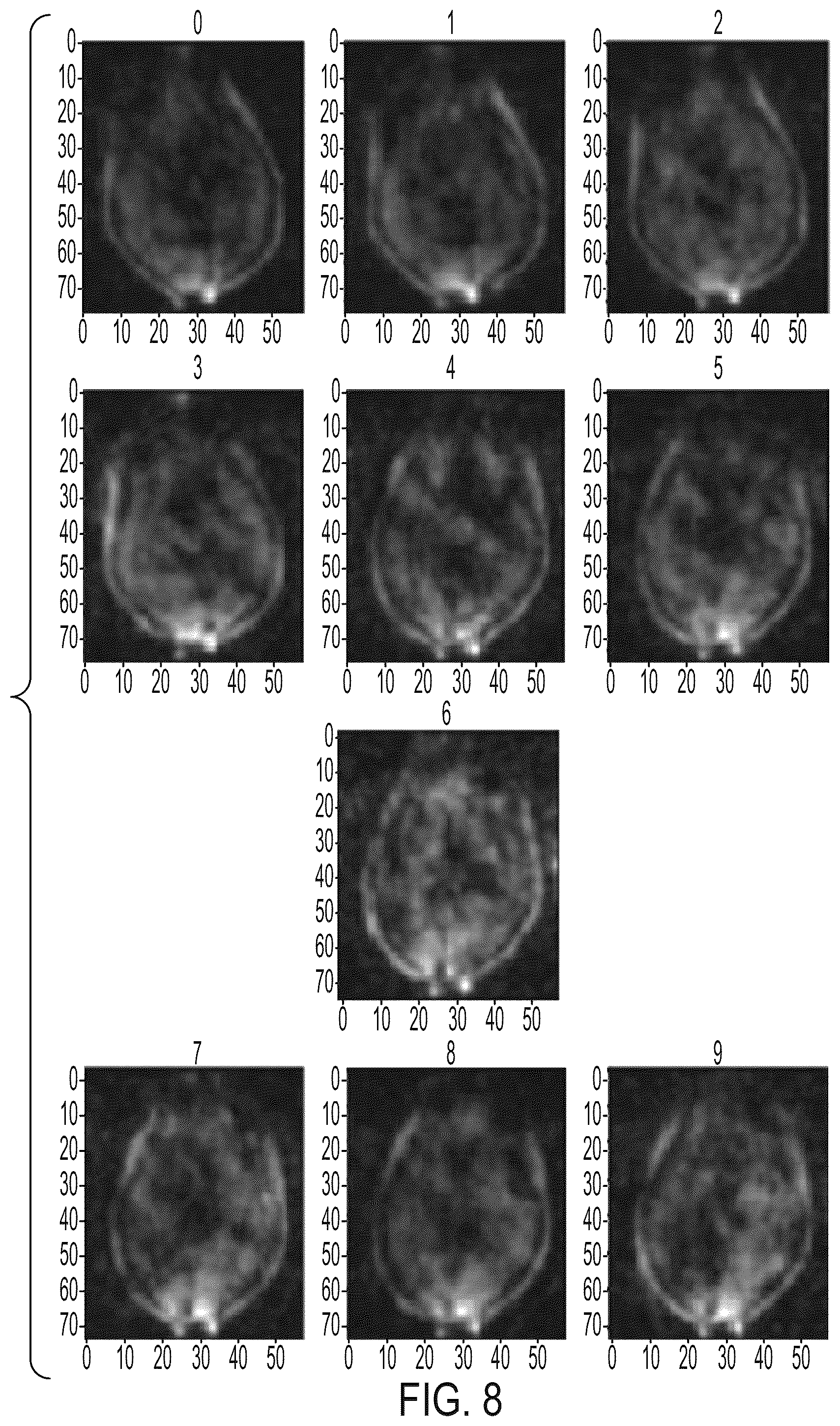 Patent US12105175 Figure 14 – Artefact reduction in magnetic resonance imaging