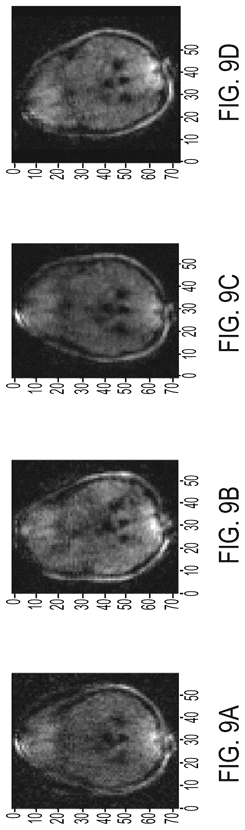 Patent US12105175 Figure 15 – Artefact reduction in magnetic resonance imaging