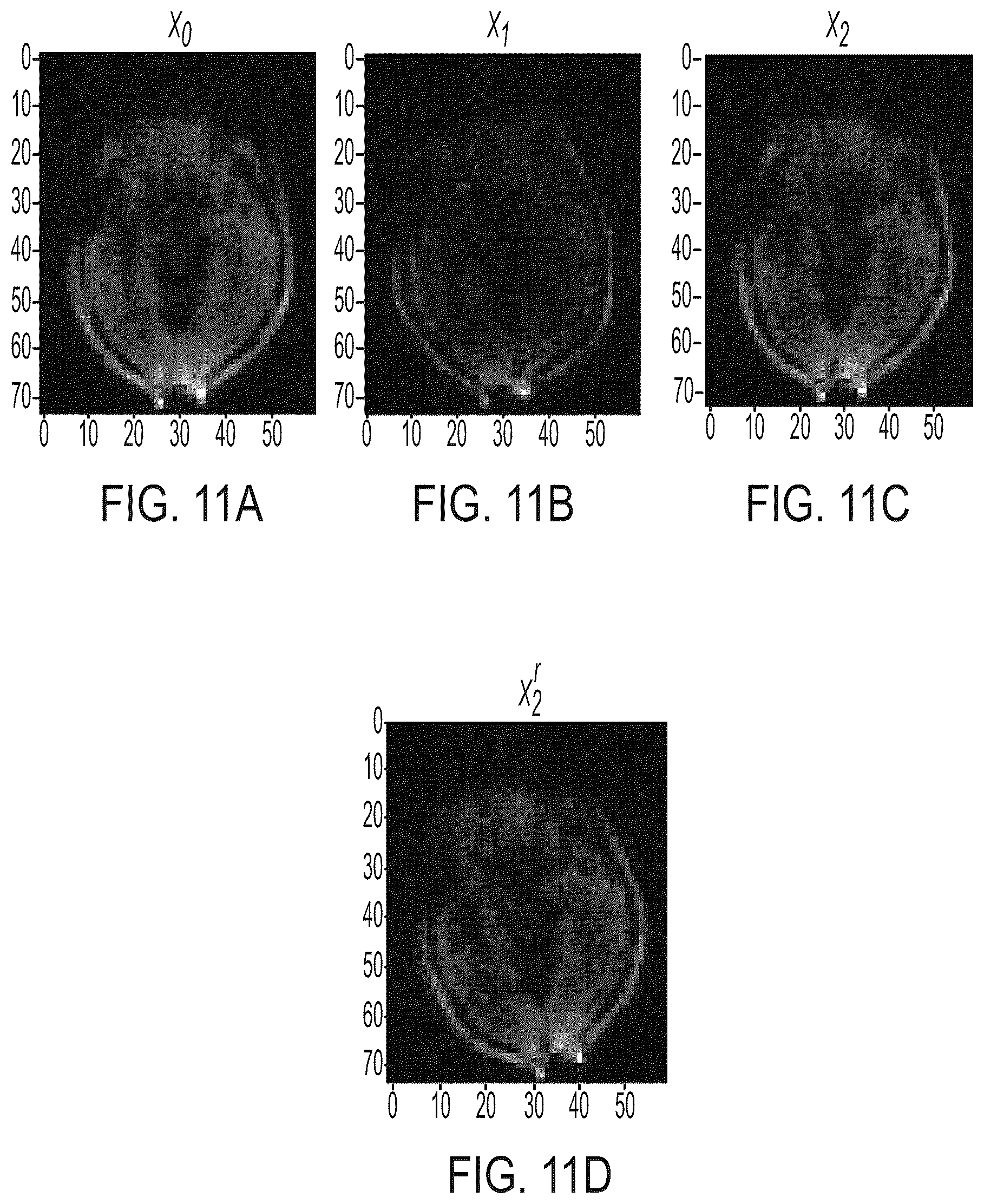 Patent US12105175 Figure 17 – Artefact reduction in magnetic resonance imaging