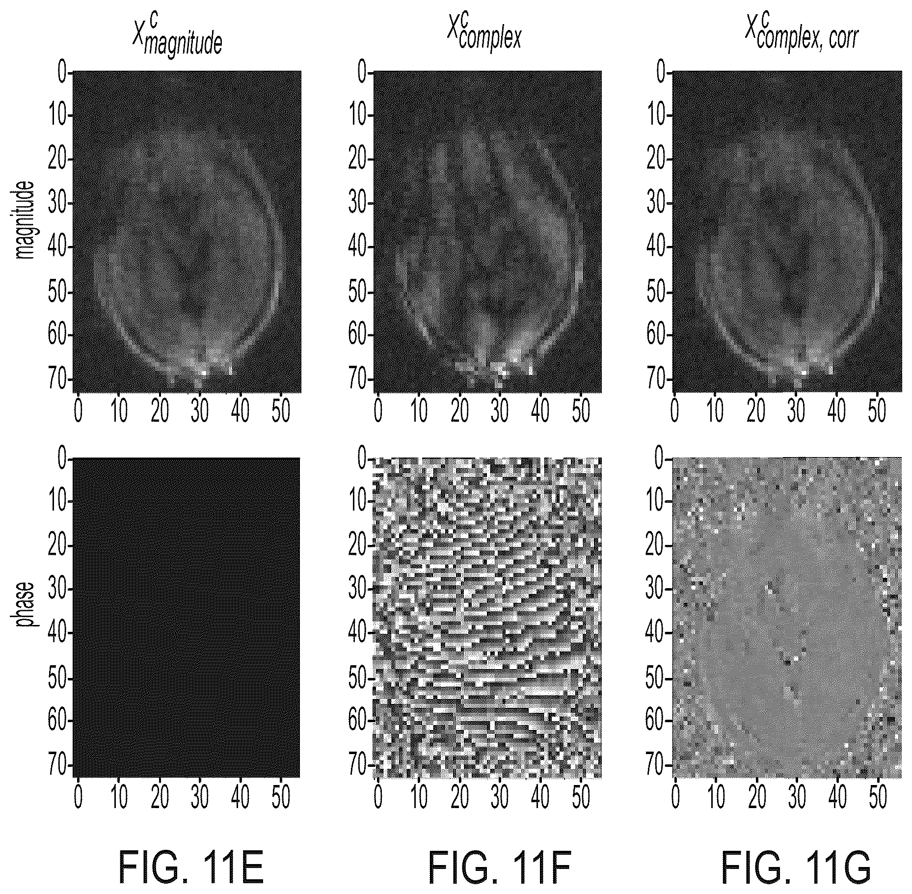 Patent US12105175 Figure 18 – Artefact reduction in magnetic resonance imaging