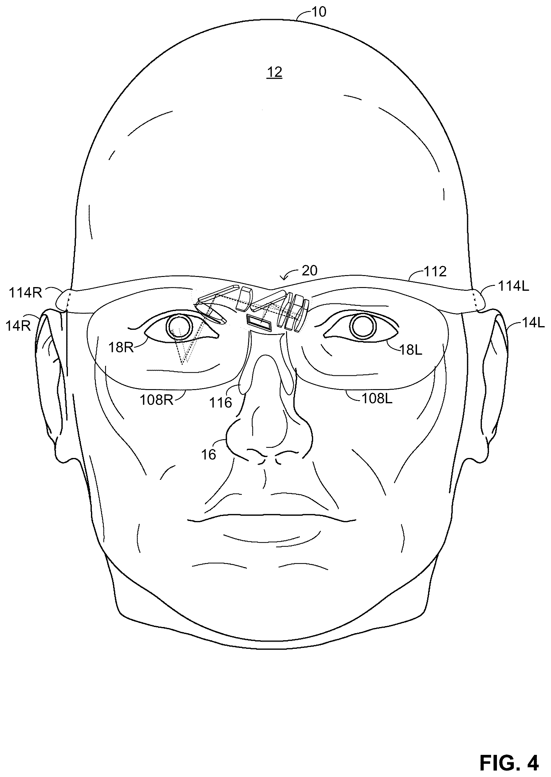 Patent US12105292 Figure 4 – Optical see through (OST) near eye display (NED) system integrating ophthalmic correction