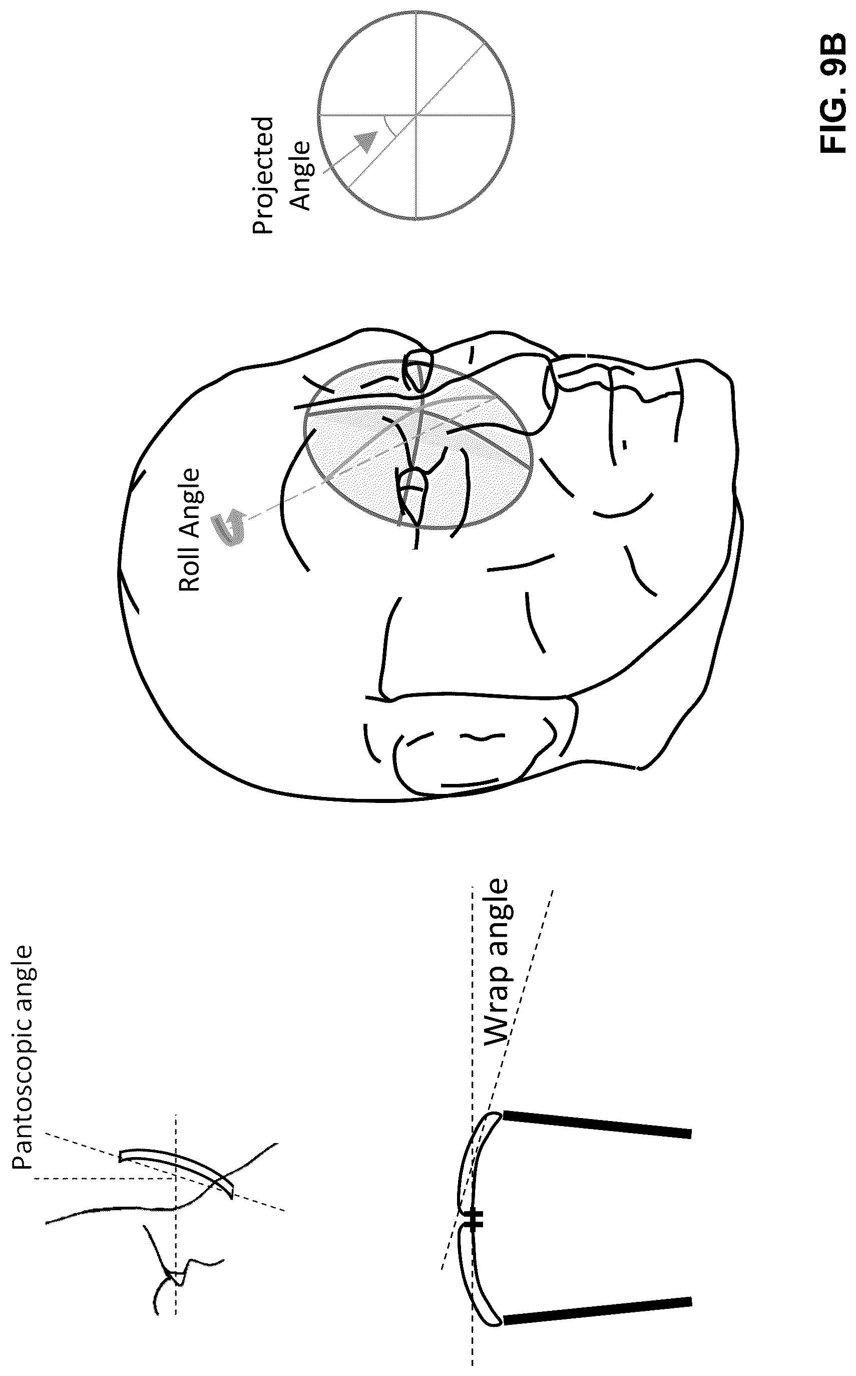 Patent US12105292 Figure 11 – Optical see through (OST) near eye display (NED) system integrating ophthalmic correction