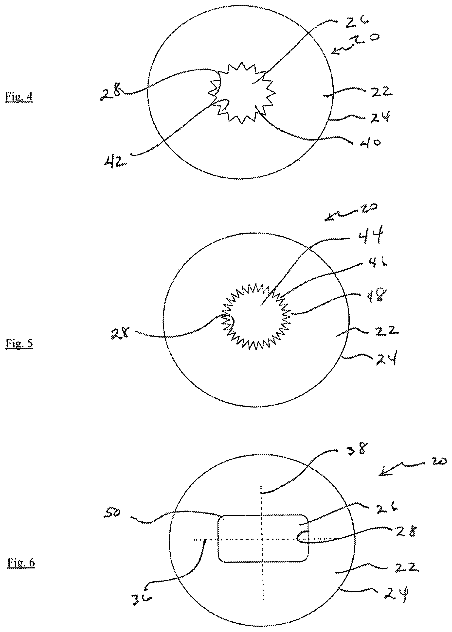 Patent US12105359 Figure 2 – Tear shaping for refractive correction