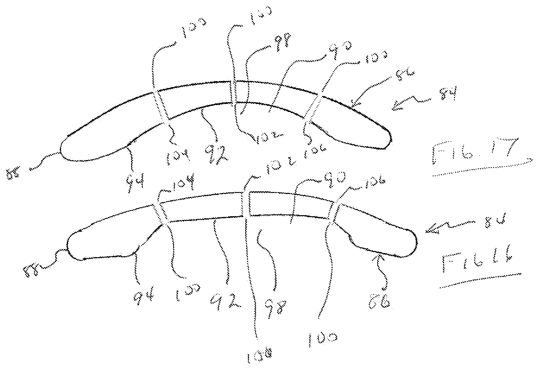 Patent US12105359 Figure 11 – Tear shaping for refractive correction