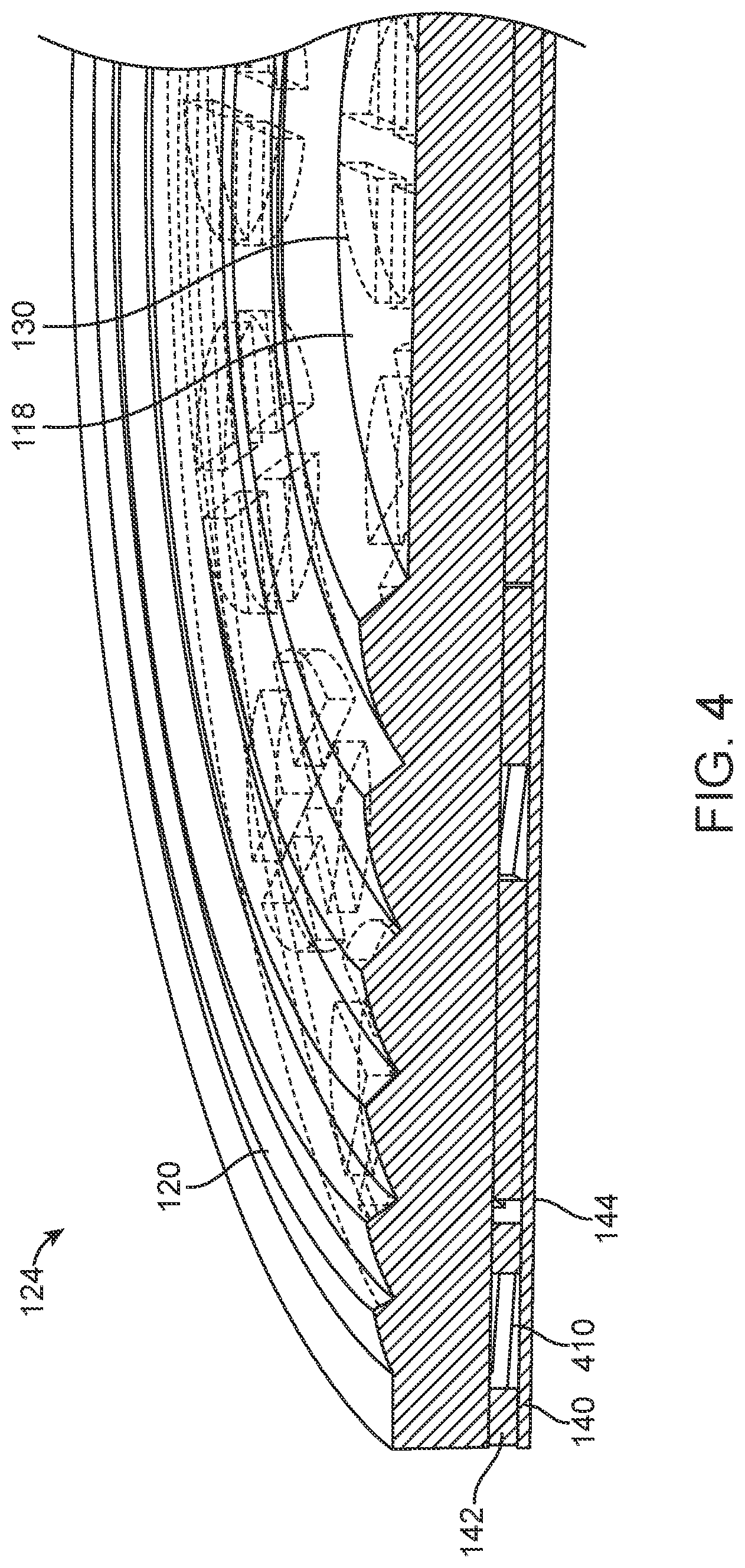 Patent US12105362 Figure 4 – Stick on devices using peripheral defocus to treat progressive refractive error