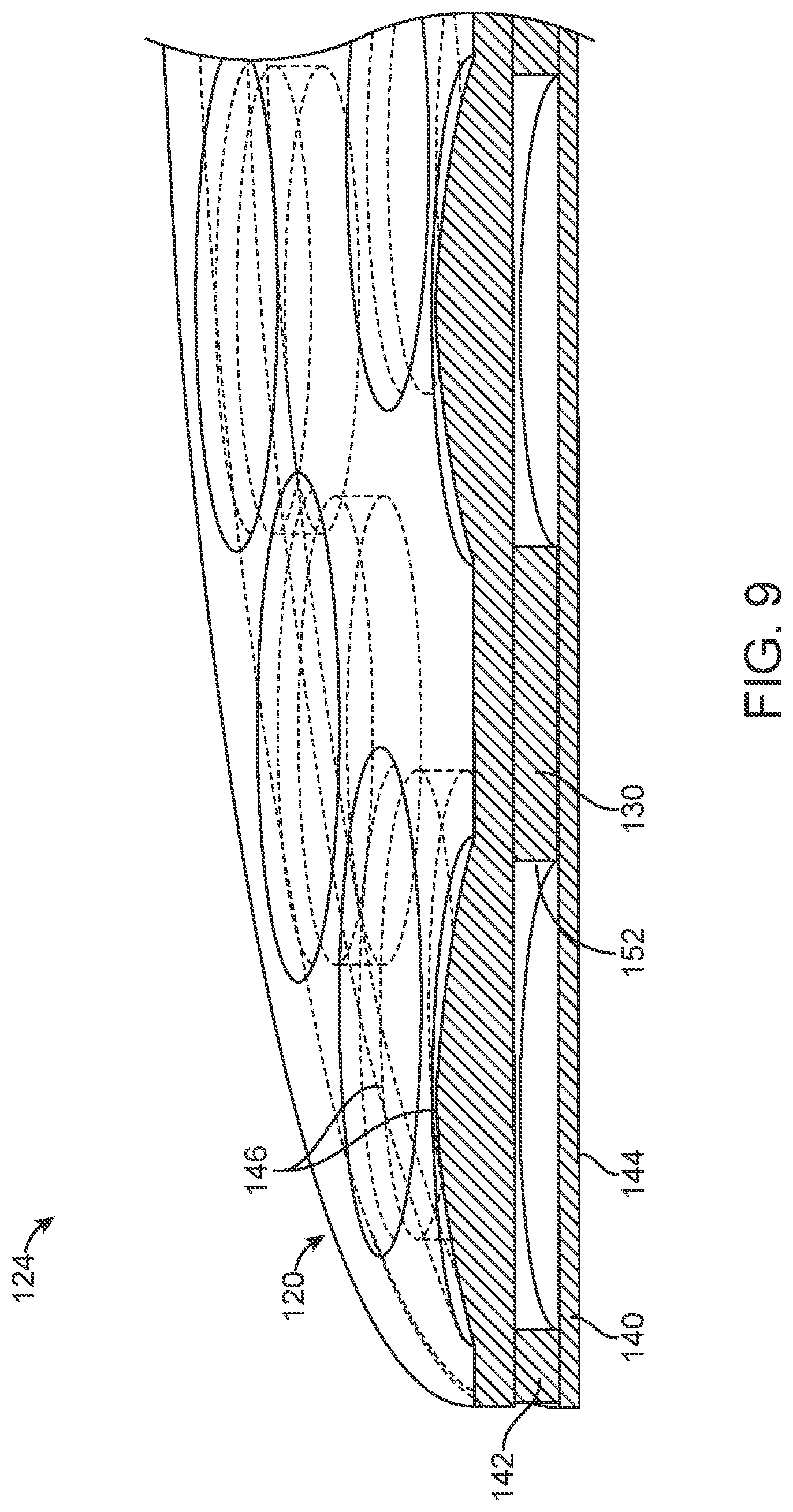 Patent US12105362 Figure 9 – Stick on devices using peripheral defocus to treat progressive refractive error