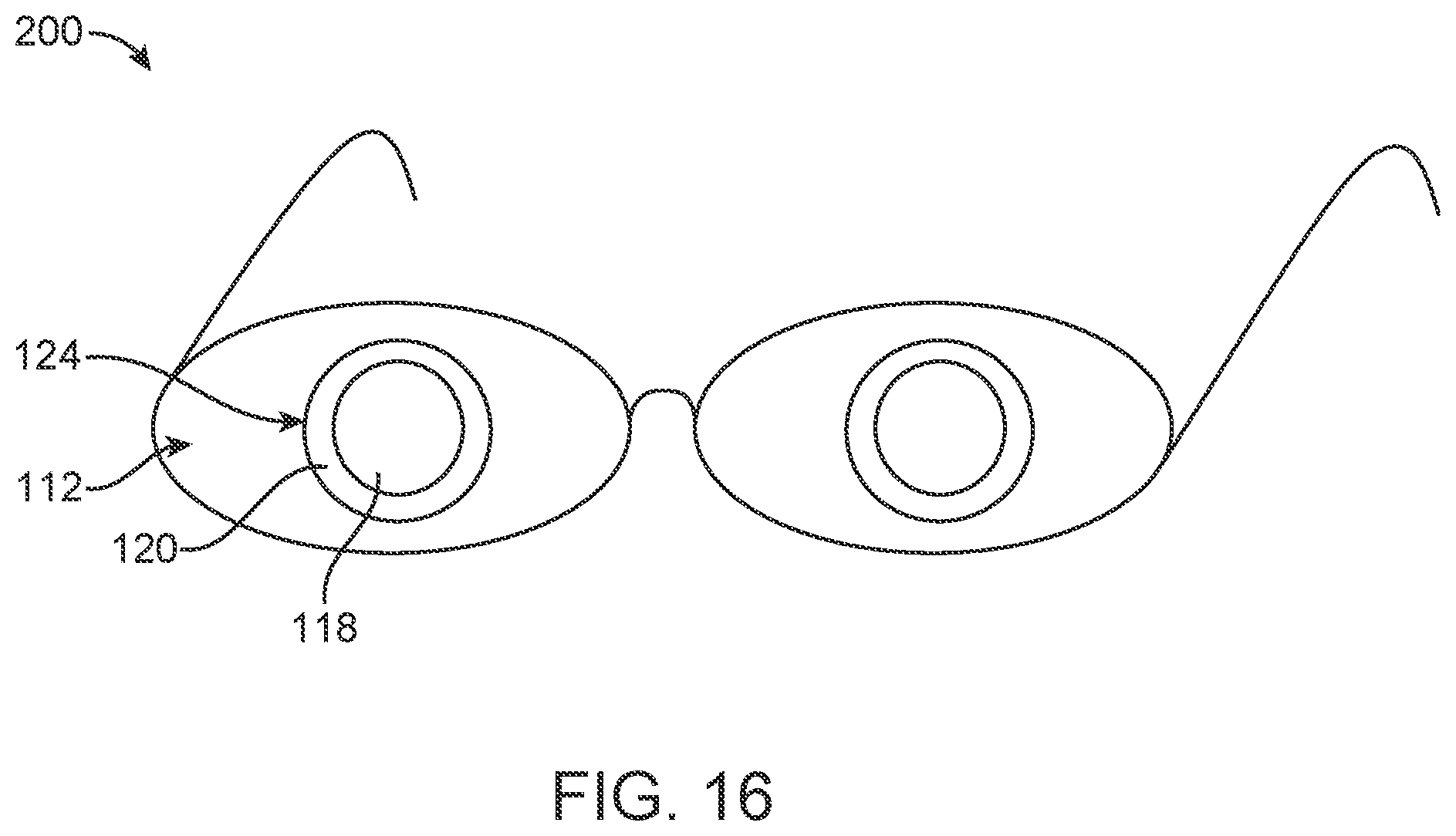 Patent US12105362 Figure 16 – Stick on devices using peripheral defocus to treat progressive refractive error