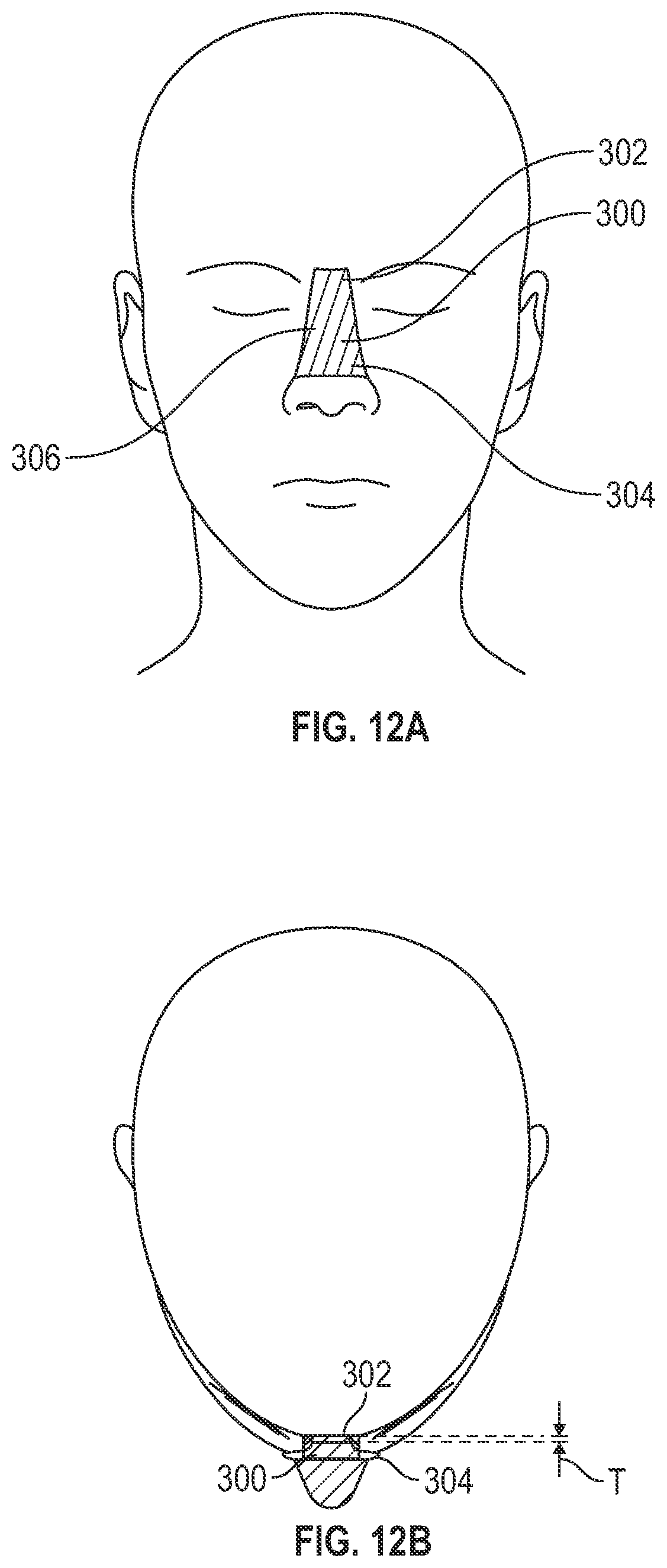 Patent US12105364 Figure 19 – Device for treating amblyopia/anisometropia