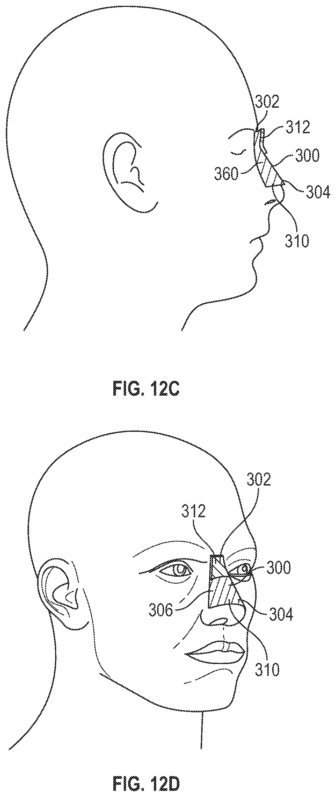 Patent US12105364 Figure 20 – Device for treating amblyopia/anisometropia