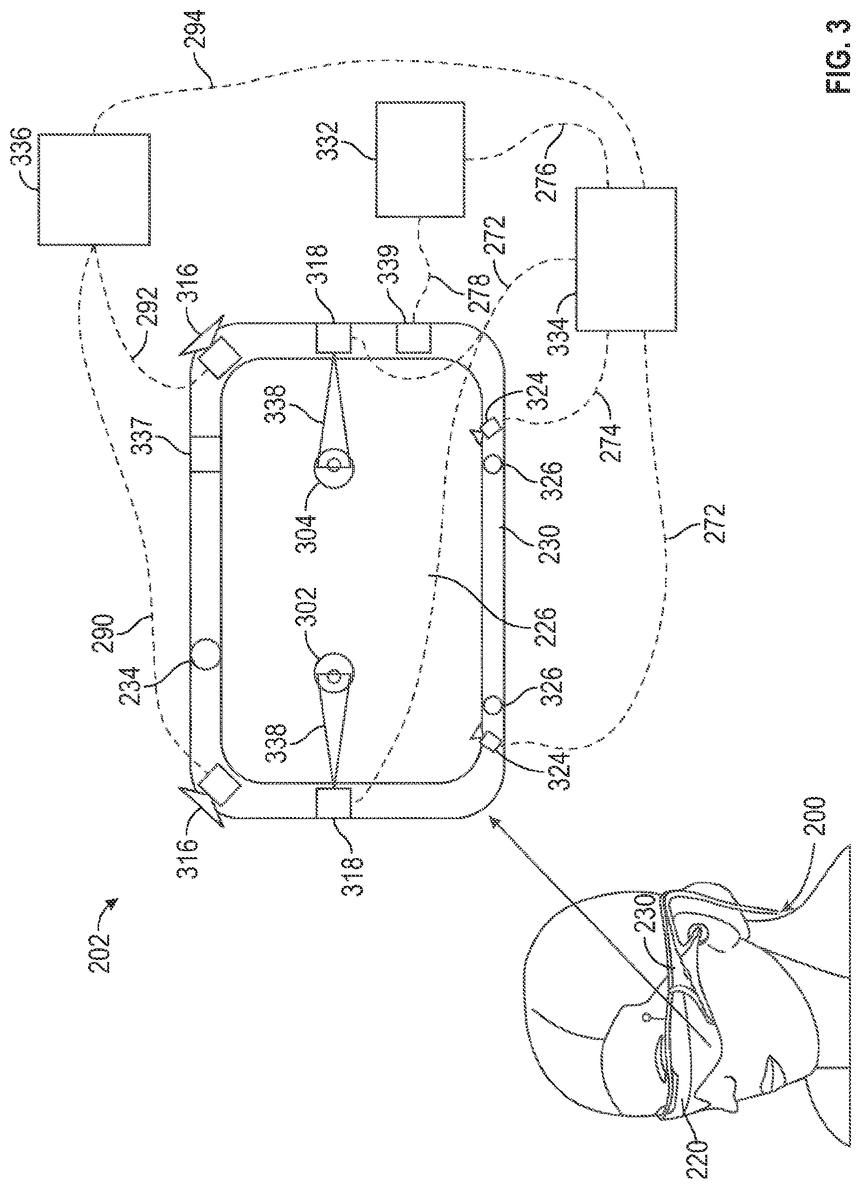 Patent US12105875 Figure 3 – Display systems and methods for determining vertical alignment between left and right displays and a user's eyes