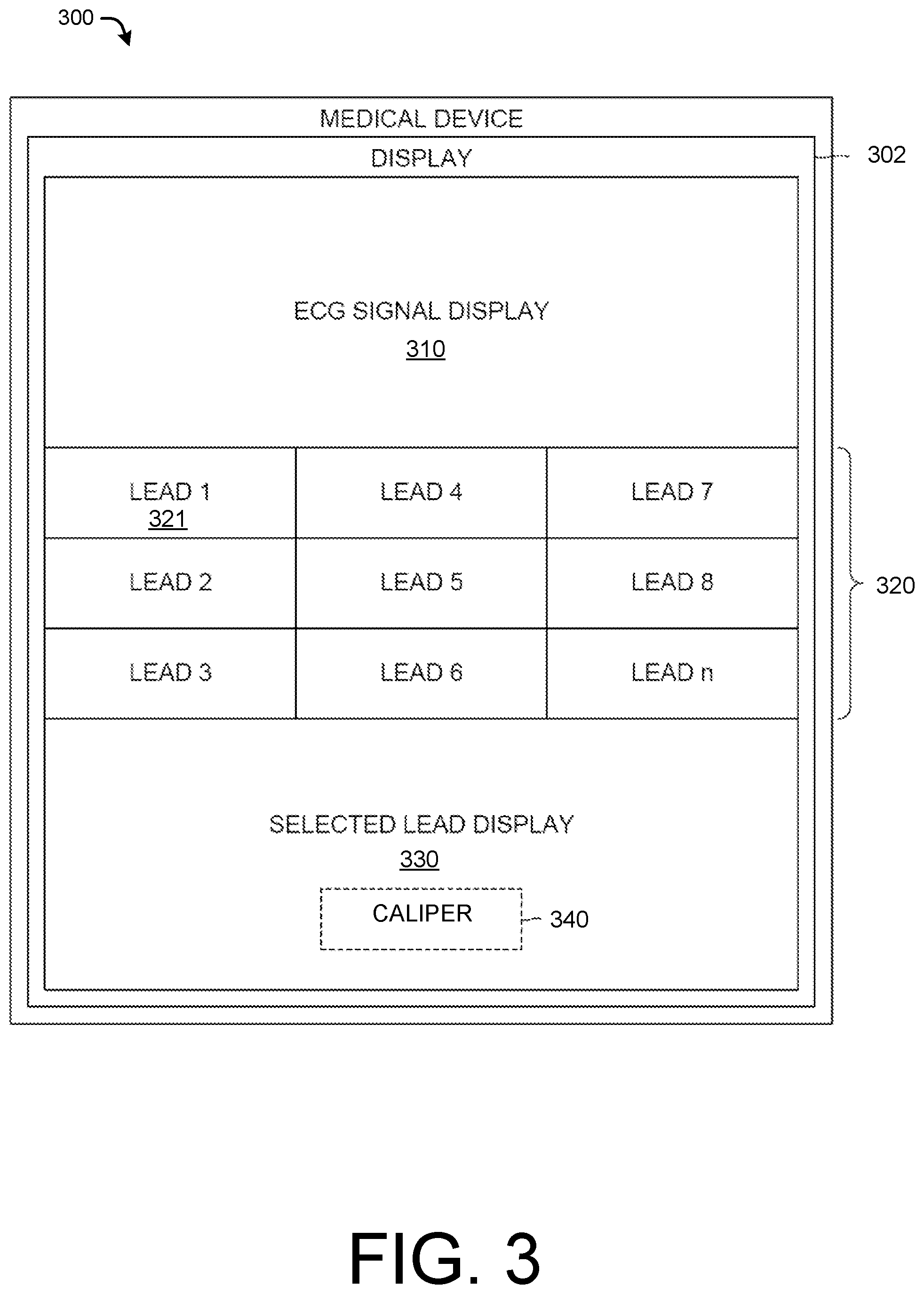 Patent US12105947 Figure 3 – Electronic electrocardiogram calipers
