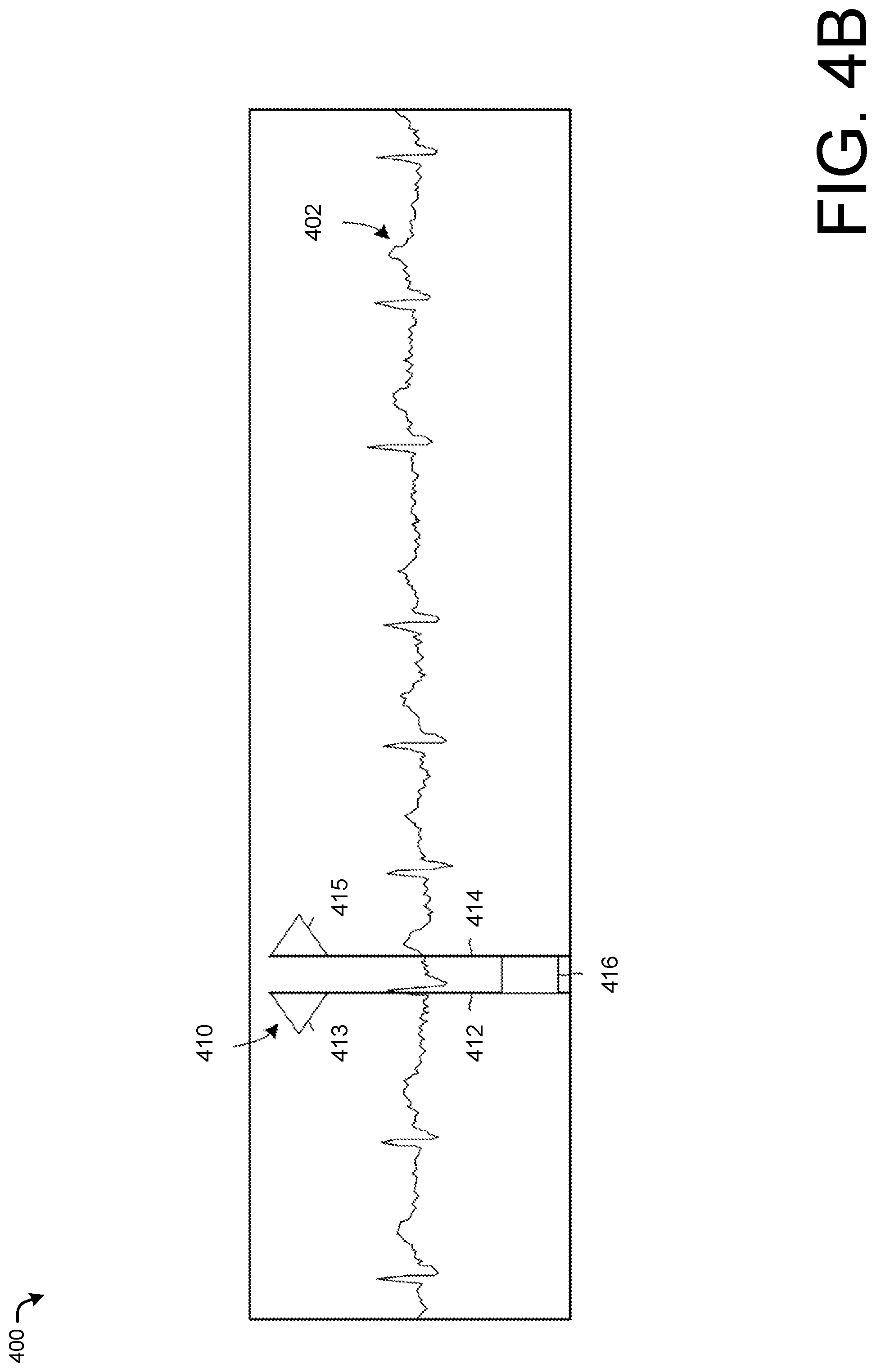 Patent US12105947 Figure 5 – Electronic electrocardiogram calipers